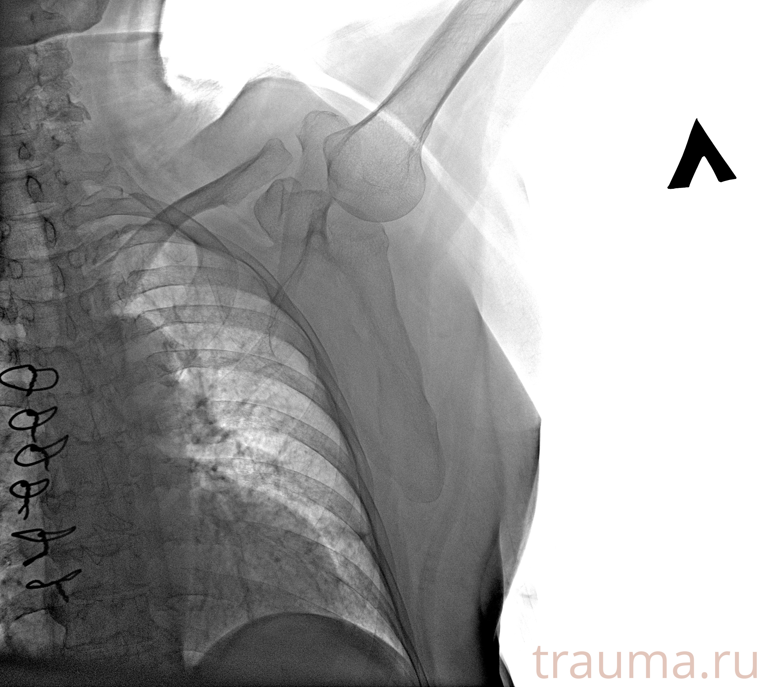Рентген на дому: по вашему адресу приезжает врач-рентгенолог, травматолог-ортопед с мобильным рентгеновским аппаратом, проводит диагностику травмы или заболевания, делает необходимые рентгенограммы, дает рекомендации по дальнейшему лечению. Получить качественные снимки в домашних условиях возможно благодаря уникальной методике, разработанной МосРентген Центром для института  Склифосовского