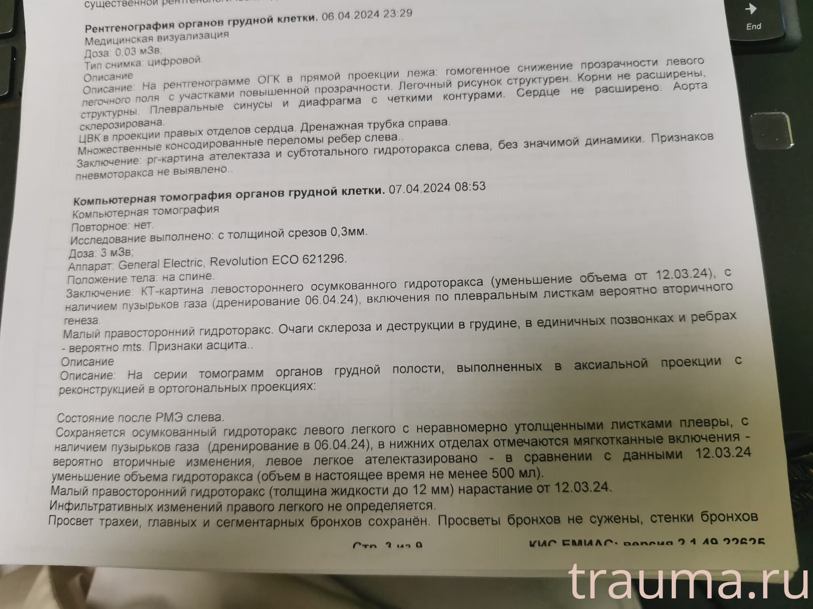 Рентген на дому: по вашему адресу приезжает врач-рентгенолог, травматолог-ортопед с мобильным рентгеновским аппаратом, проводит диагностику травмы или заболевания, делает необходимые рентгенограммы, дает рекомендации по дальнейшему лечению. Получить качественные снимки в домашних условиях возможно благодаря уникальной методике, разработанной МосРентген Центром для института  Склифосовского