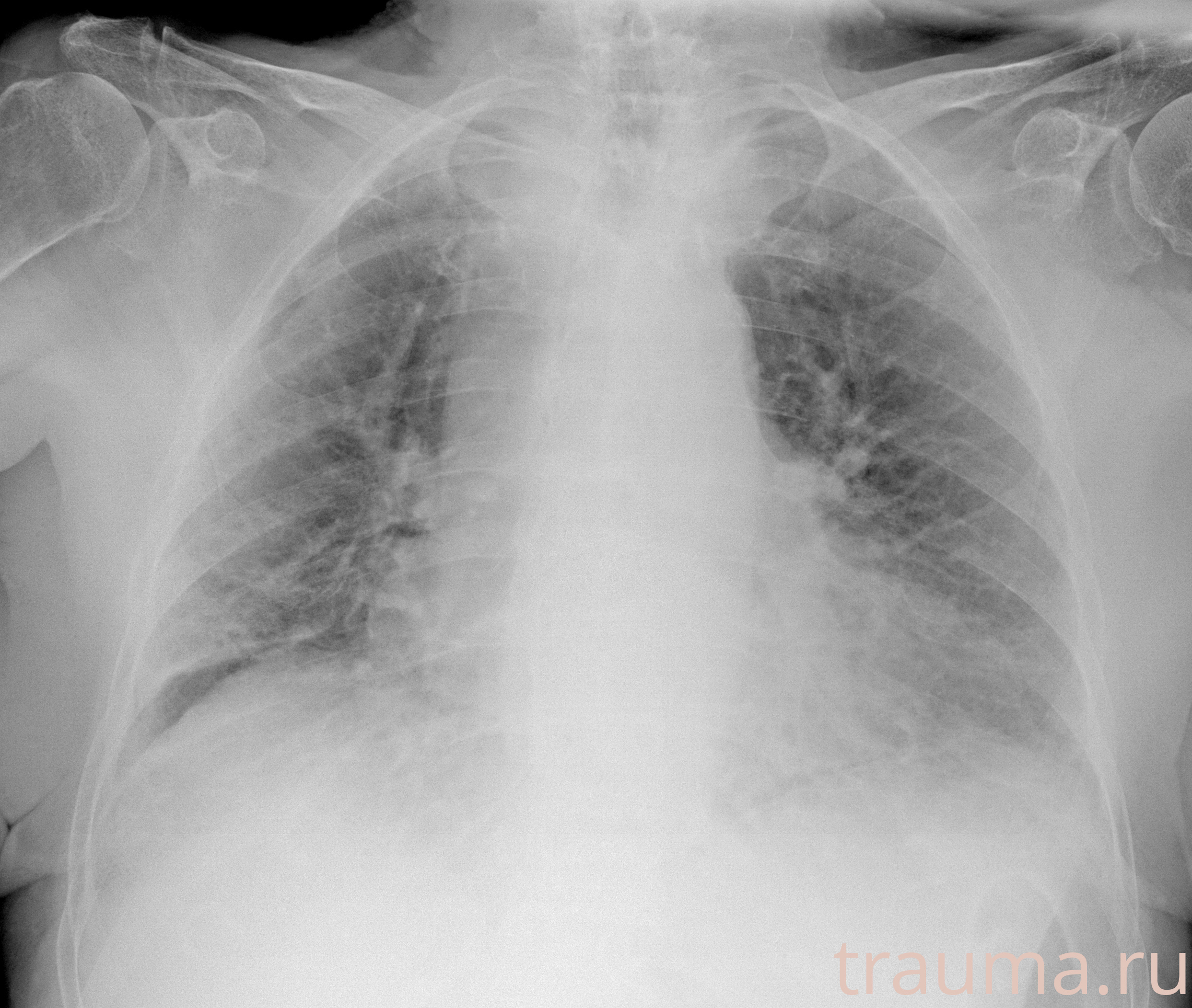 Рентген на дому: по вашему адресу приезжает врач-рентгенолог, травматолог-ортопед с мобильным рентгеновским аппаратом, проводит диагностику травмы или заболевания, делает необходимые рентгенограммы, дает рекомендации по дальнейшему лечению. Получить качественные снимки в домашних условиях возможно благодаря уникальной методике, разработанной МосРентген Центром для института  Склифосовского