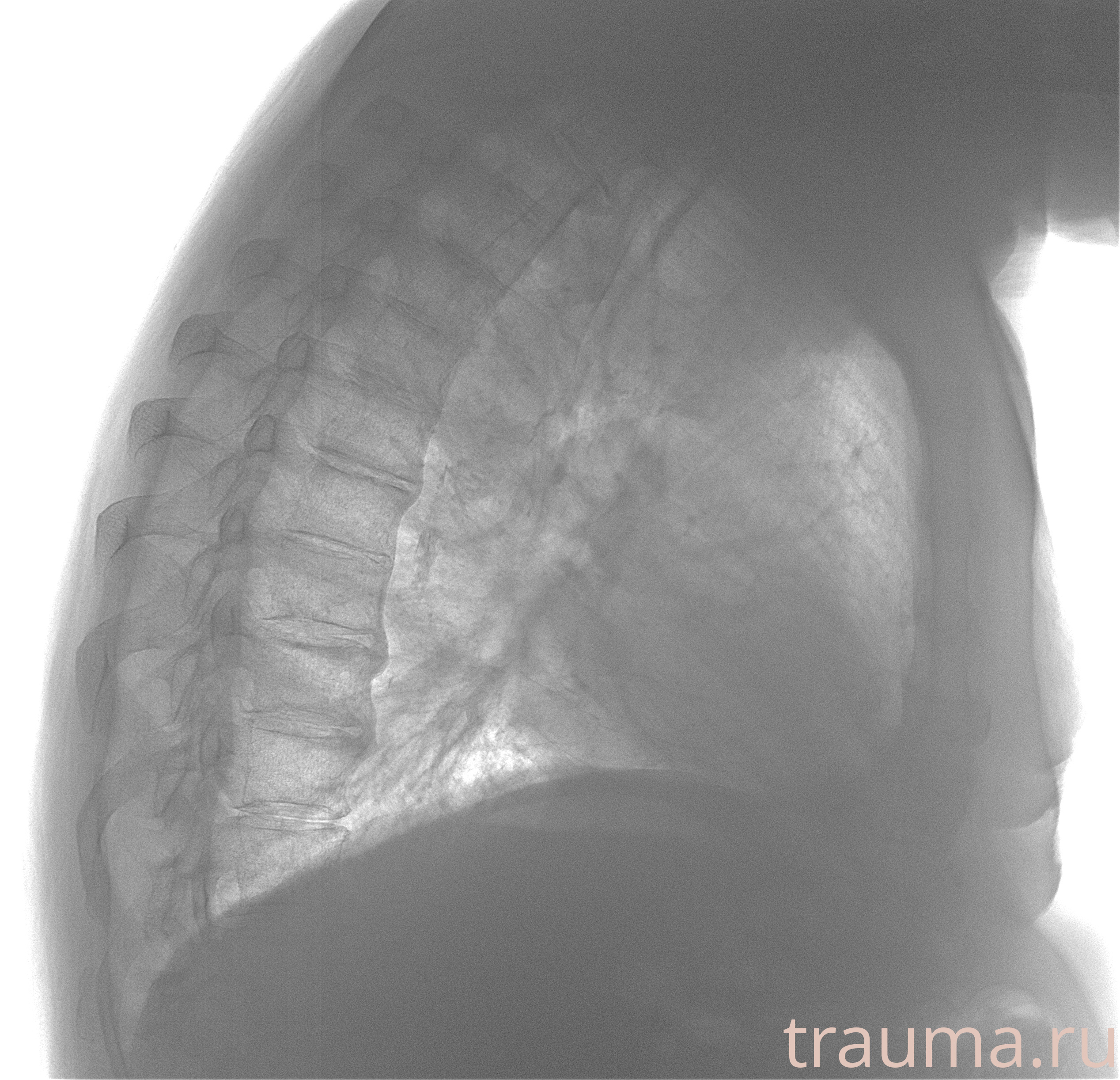 Рентген на дому: по вашему адресу приезжает врач-рентгенолог, травматолог-ортопед с мобильным рентгеновским аппаратом, проводит диагностику травмы или заболевания, делает необходимые рентгенограммы, дает рекомендации по дальнейшему лечению. Получить качественные снимки в домашних условиях возможно благодаря уникальной методике, разработанной МосРентген Центром для института  Склифосовского