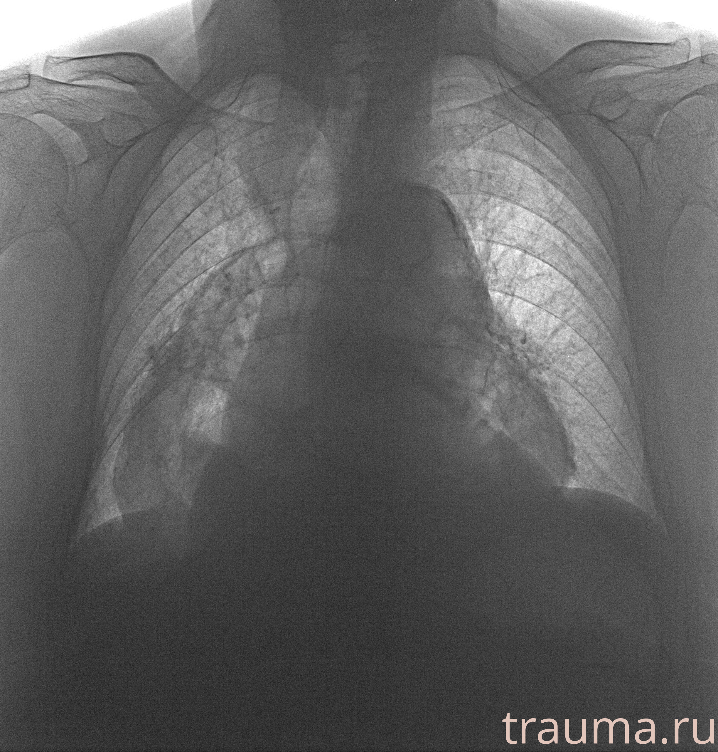 Рентген на дому: по вашему адресу приезжает врач-рентгенолог, травматолог-ортопед с мобильным рентгеновским аппаратом, проводит диагностику травмы или заболевания, делает необходимые рентгенограммы, дает рекомендации по дальнейшему лечению. Получить качественные снимки в домашних условиях возможно благодаря уникальной методике, разработанной МосРентген Центром для института  Склифосовского