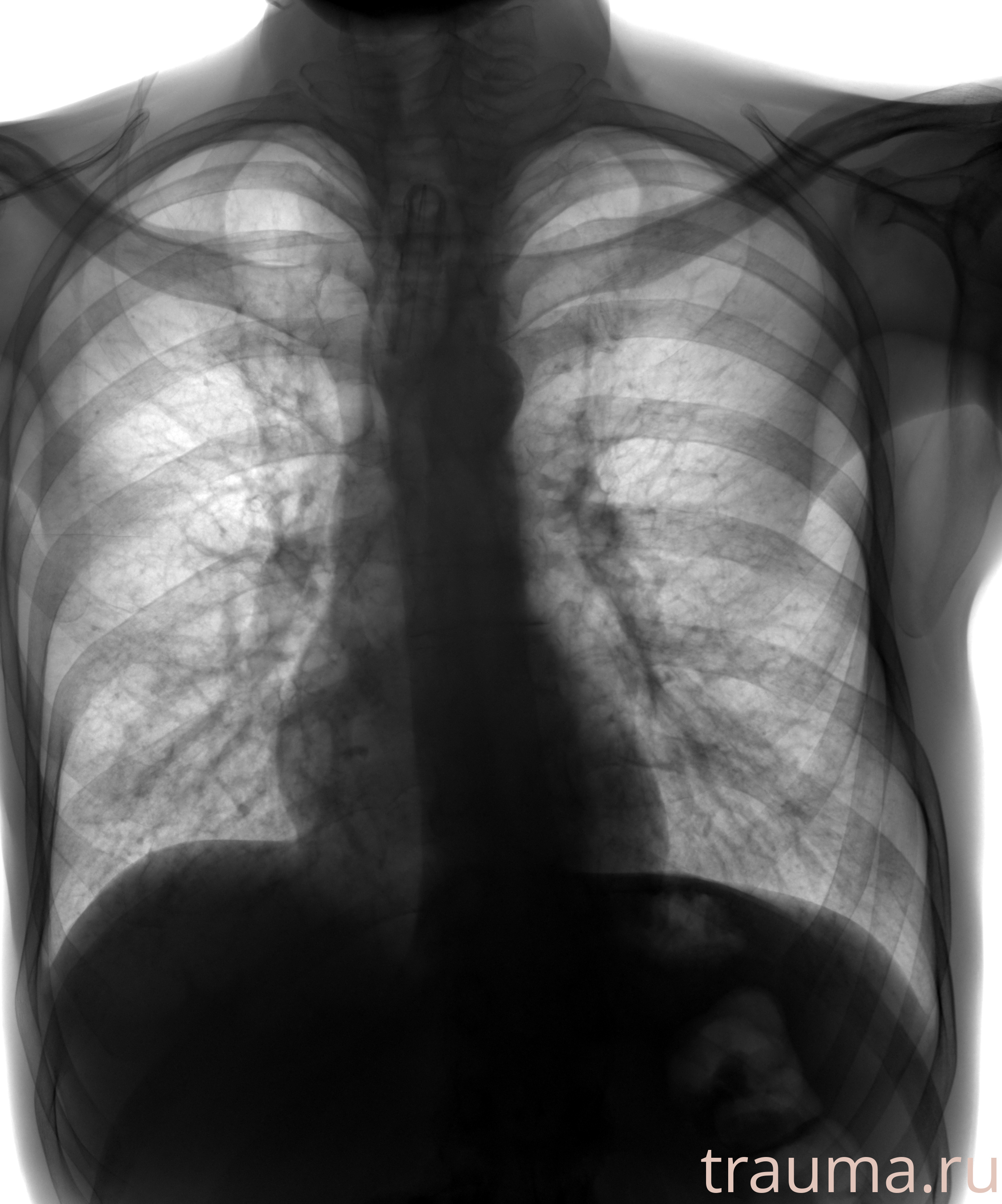 Рентген на дому: по вашему адресу приезжает врач-рентгенолог, травматолог-ортопед с мобильным рентгеновским аппаратом, проводит диагностику травмы или заболевания, делает необходимые рентгенограммы, дает рекомендации по дальнейшему лечению. Получить качественные снимки в домашних условиях возможно благодаря уникальной методике, разработанной МосРентген Центром для института  Склифосовского