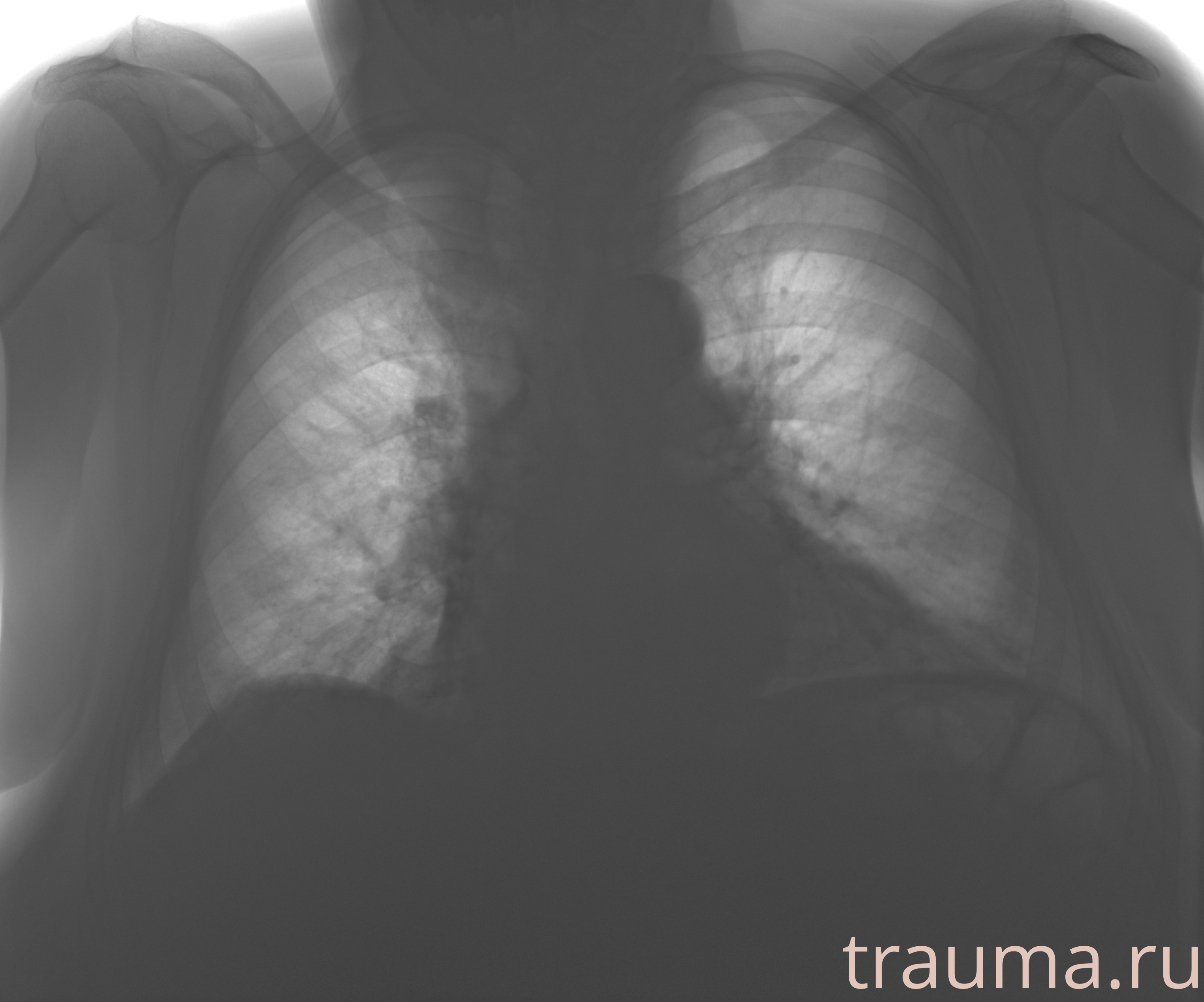 Рентген на дому: по вашему адресу приезжает врач-рентгенолог, травматолог-ортопед с мобильным рентгеновским аппаратом, проводит диагностику травмы или заболевания, делает необходимые рентгенограммы, дает рекомендации по дальнейшему лечению. Получить качественные снимки в домашних условиях возможно благодаря уникальной методике, разработанной МосРентген Центром для института  Склифосовского