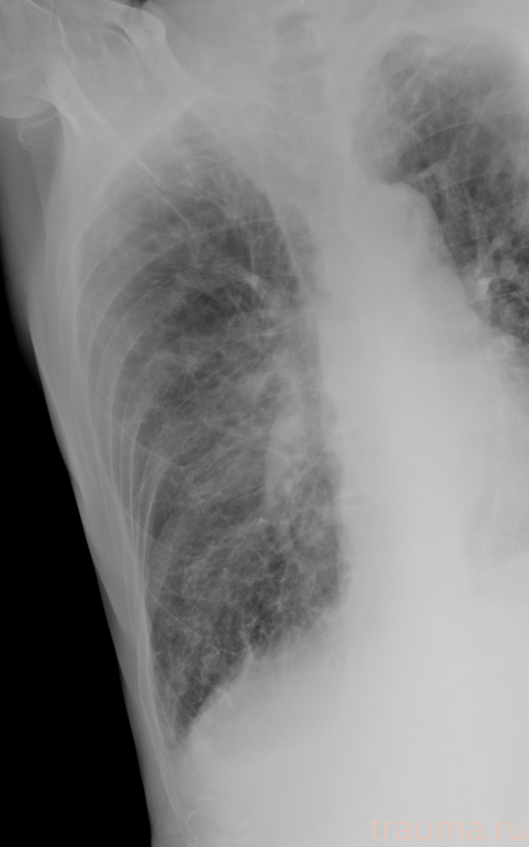 Рентген на дому: по вашему адресу приезжает врач-рентгенолог, травматолог-ортопед с мобильным рентгеновским аппаратом, проводит диагностику травмы или заболевания, делает необходимые рентгенограммы, дает рекомендации по дальнейшему лечению. Получить качественные снимки в домашних условиях возможно благодаря уникальной методике, разработанной МосРентген Центром для института  Склифосовского