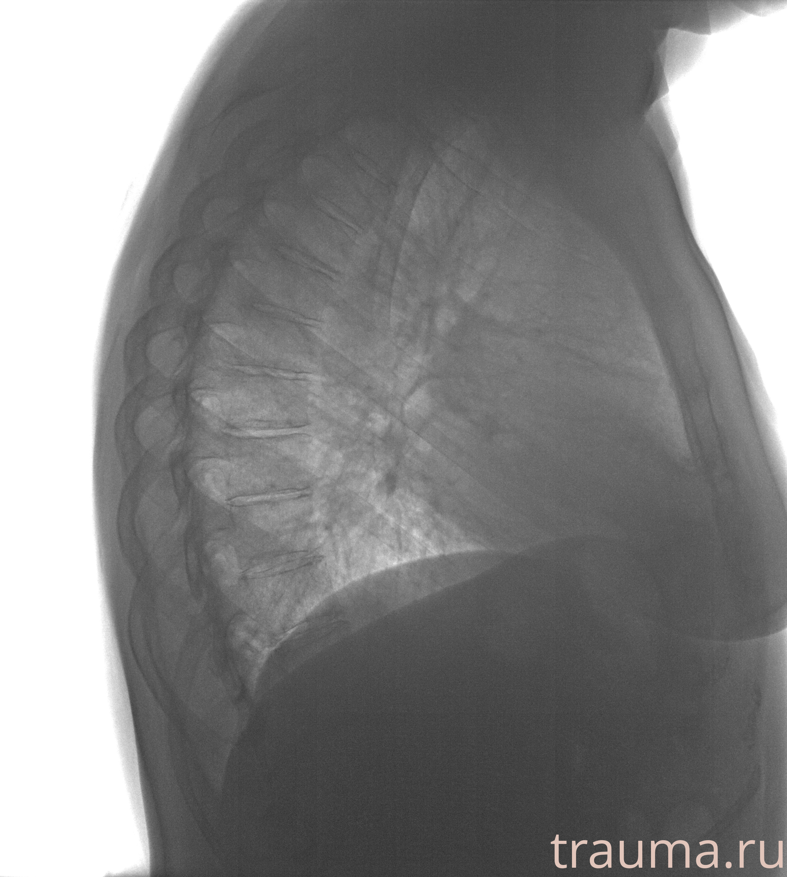 Рентген на дому: по вашему адресу приезжает врач-рентгенолог, травматолог-ортопед с мобильным рентгеновским аппаратом, проводит диагностику травмы или заболевания, делает необходимые рентгенограммы, дает рекомендации по дальнейшему лечению. Получить качественные снимки в домашних условиях возможно благодаря уникальной методике, разработанной МосРентген Центром для института  Склифосовского