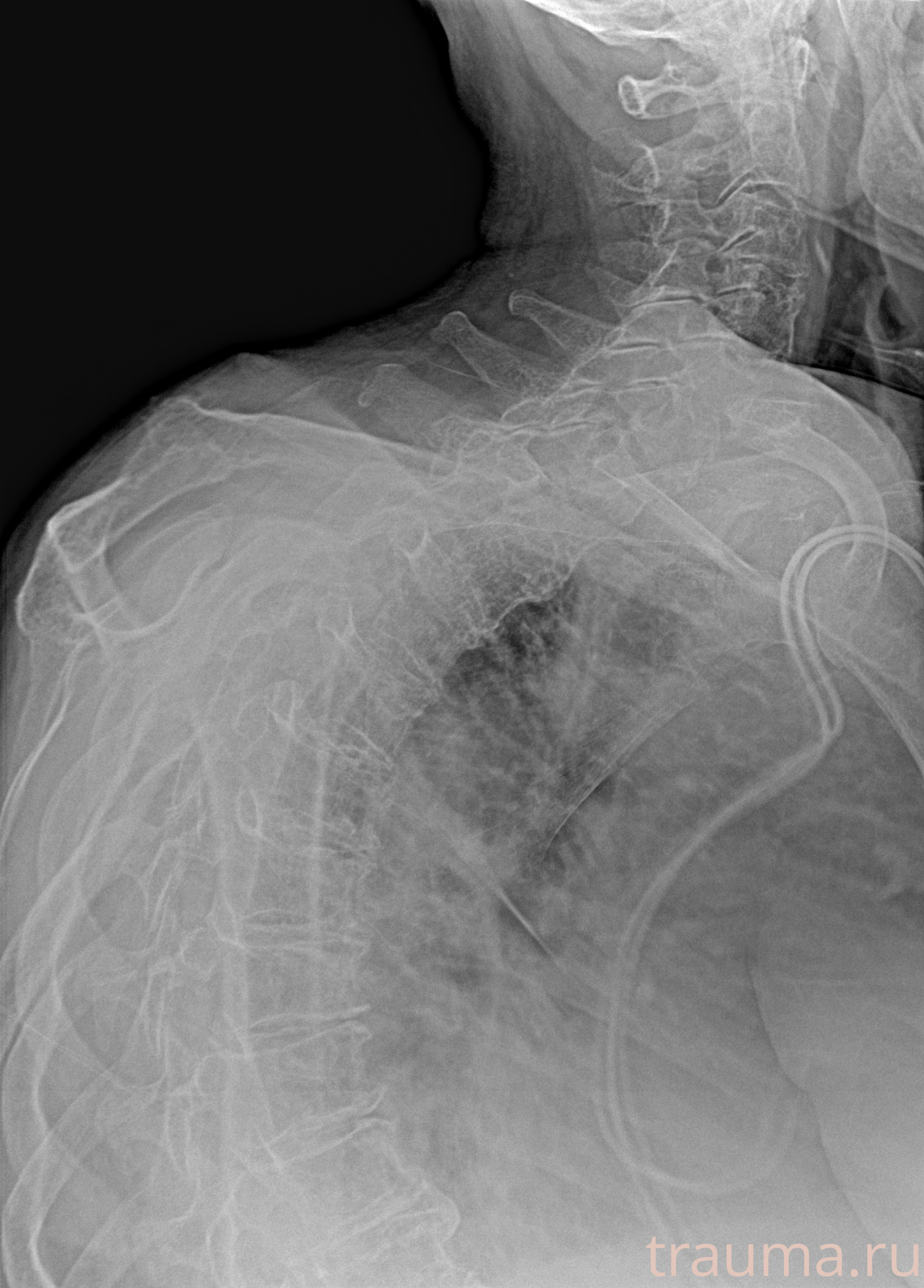 Рентген на дому: по вашему адресу приезжает врач-рентгенолог, травматолог-ортопед с мобильным рентгеновским аппаратом, проводит диагностику травмы или заболевания, делает необходимые рентгенограммы, дает рекомендации по дальнейшему лечению. Получить качественные снимки в домашних условиях возможно благодаря уникальной методике, разработанной МосРентген Центром для института  Склифосовского
