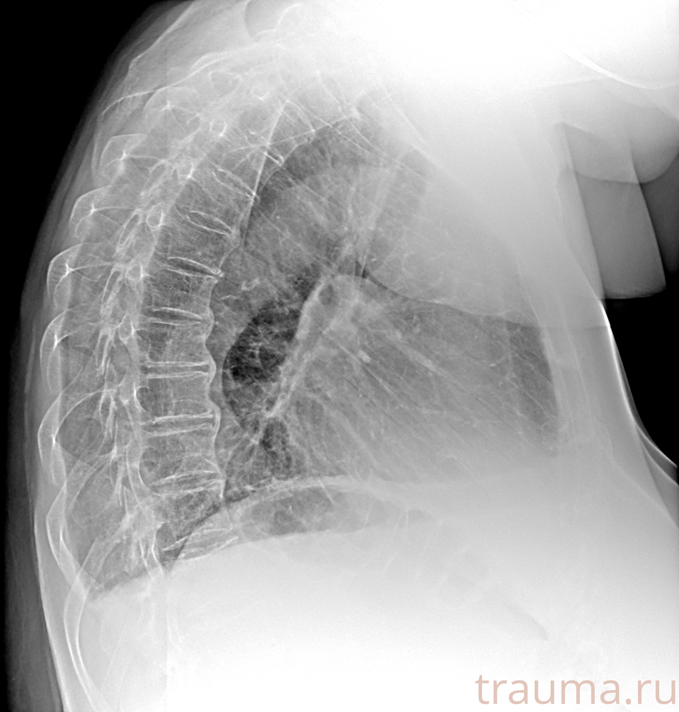 Рентген на дому: по вашему адресу приезжает врач-рентгенолог, травматолог-ортопед с мобильным рентгеновским аппаратом, проводит диагностику травмы или заболевания, делает необходимые рентгенограммы, дает рекомендации по дальнейшему лечению. Получить качественные снимки в домашних условиях возможно благодаря уникальной методике, разработанной МосРентген Центром для института  Склифосовского