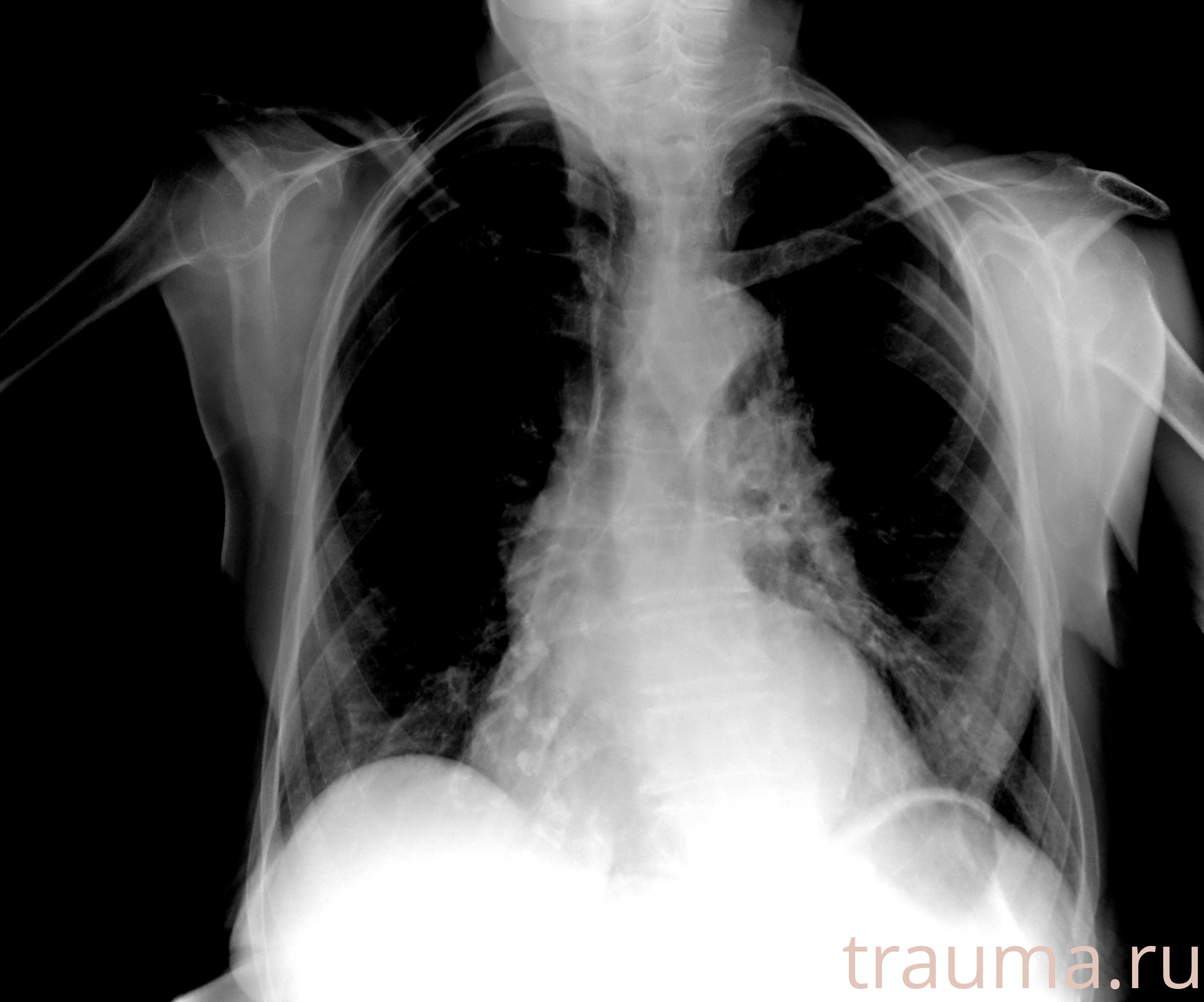 Рентген на дому: по вашему адресу приезжает врач-рентгенолог, травматолог-ортопед с мобильным рентгеновским аппаратом, проводит диагностику травмы или заболевания, делает необходимые рентгенограммы, дает рекомендации по дальнейшему лечению. Получить качественные снимки в домашних условиях возможно благодаря уникальной методике, разработанной МосРентген Центром для института  Склифосовского