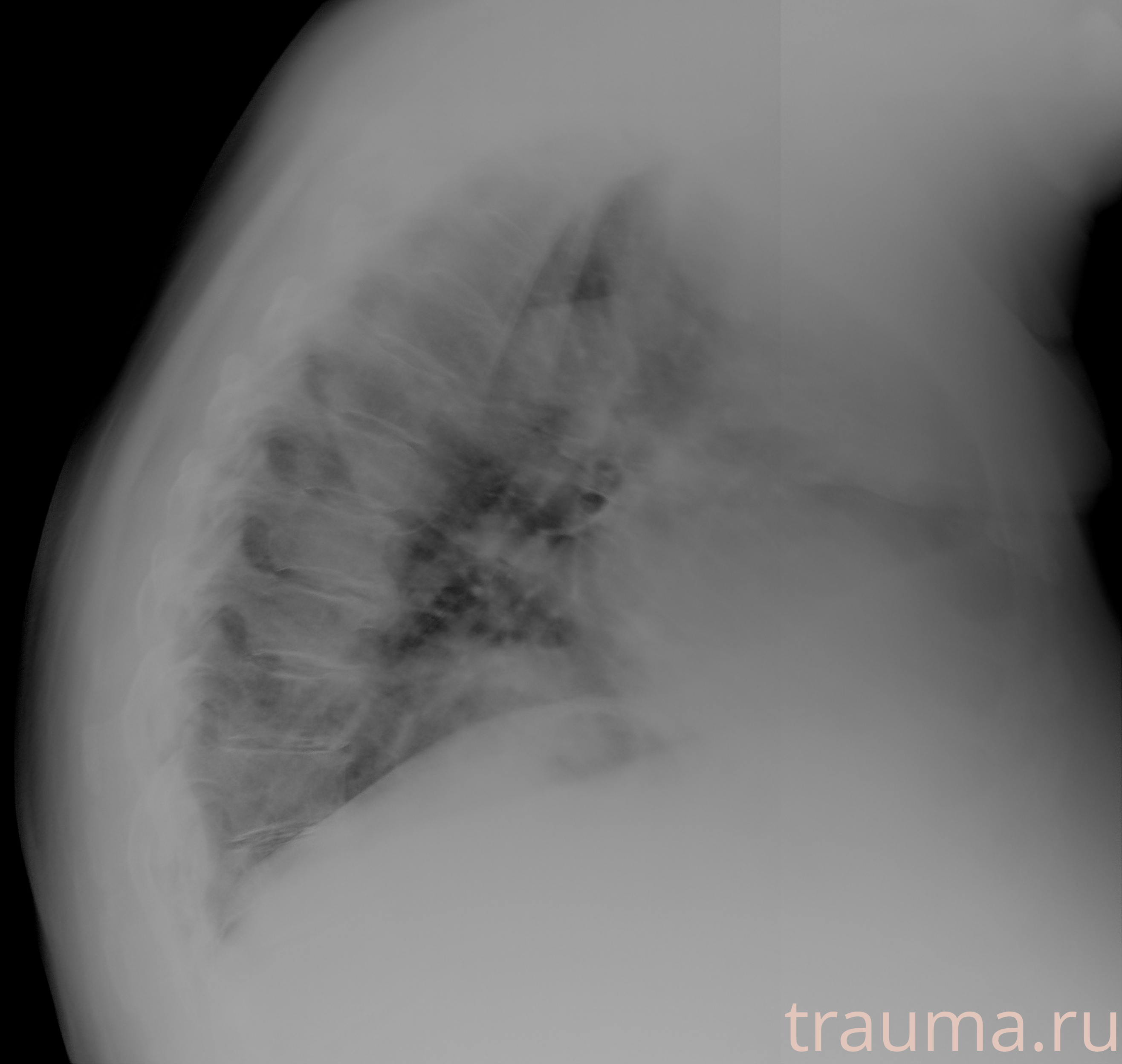 Рентген на дому: по вашему адресу приезжает врач-рентгенолог, травматолог-ортопед с мобильным рентгеновским аппаратом, проводит диагностику травмы или заболевания, делает необходимые рентгенограммы, дает рекомендации по дальнейшему лечению. Получить качественные снимки в домашних условиях возможно благодаря уникальной методике, разработанной МосРентген Центром для института  Склифосовского