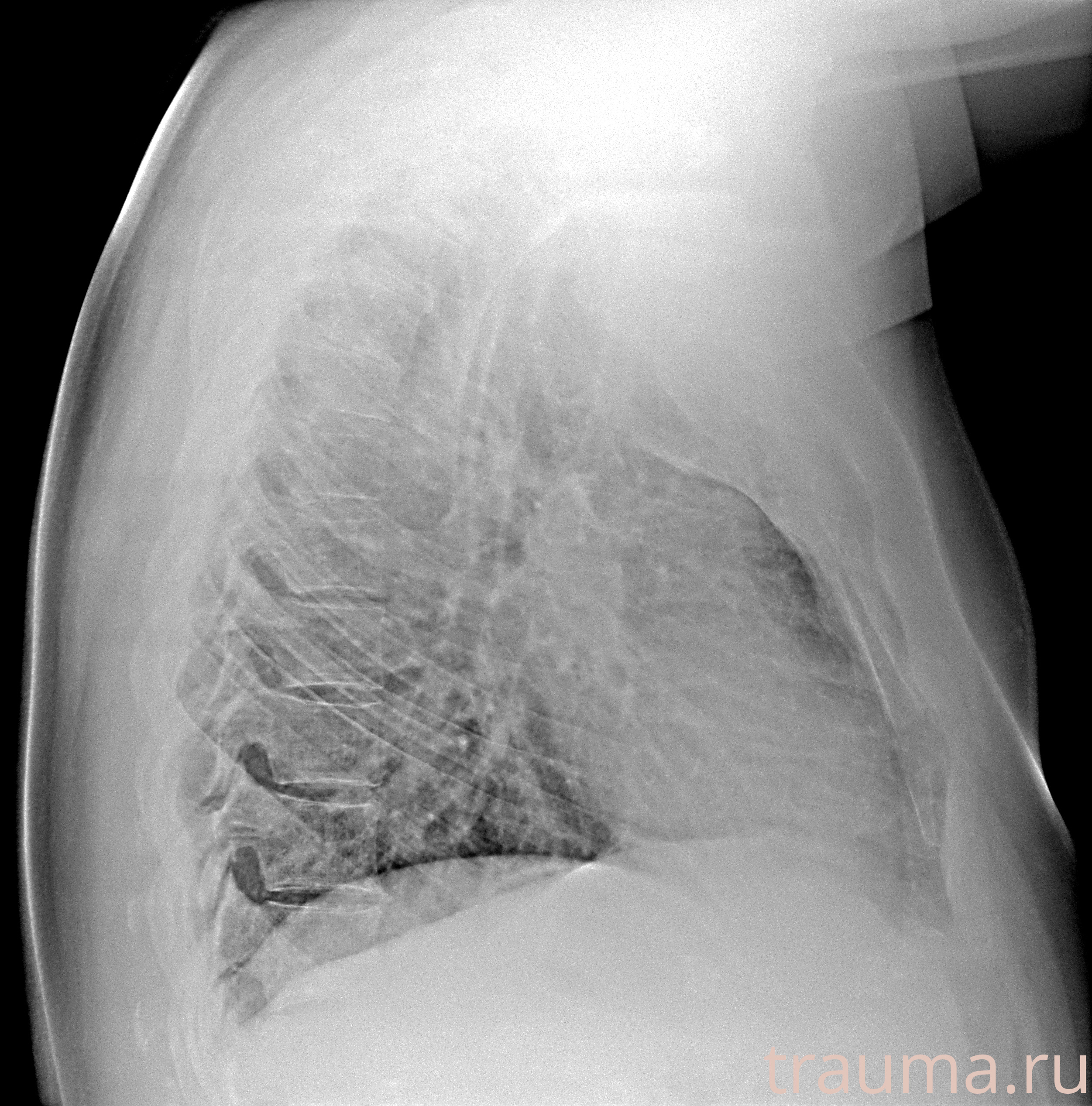 Рентген на дому: по вашему адресу приезжает врач-рентгенолог, травматолог-ортопед с мобильным рентгеновским аппаратом, проводит диагностику травмы или заболевания, делает необходимые рентгенограммы, дает рекомендации по дальнейшему лечению. Получить качественные снимки в домашних условиях возможно благодаря уникальной методике, разработанной МосРентген Центром для института  Склифосовского