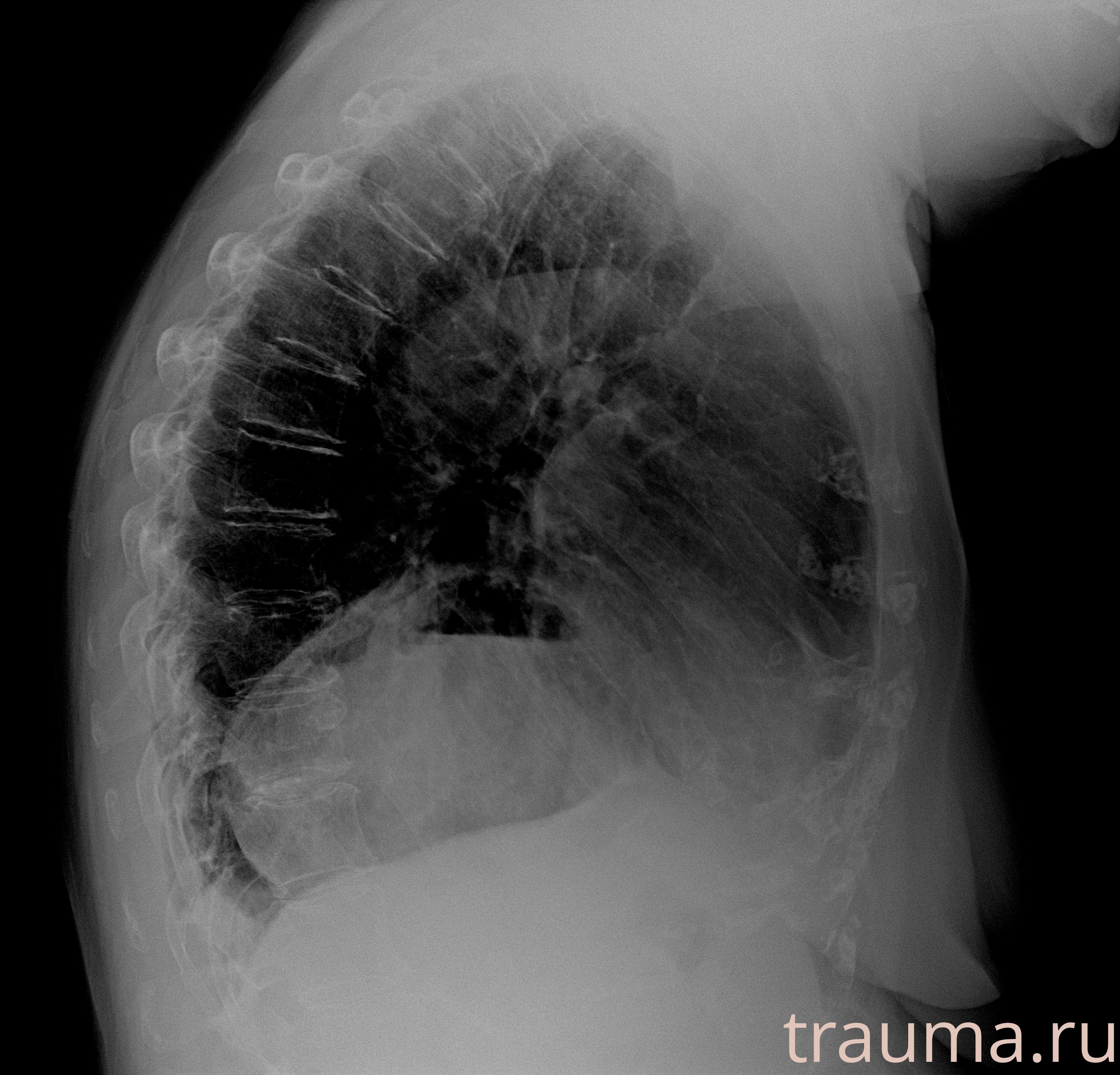 Рентген на дому: по вашему адресу приезжает врач-рентгенолог, травматолог-ортопед с мобильным рентгеновским аппаратом, проводит диагностику травмы или заболевания, делает необходимые рентгенограммы, дает рекомендации по дальнейшему лечению. Получить качественные снимки в домашних условиях возможно благодаря уникальной методике, разработанной МосРентген Центром для института  Склифосовского