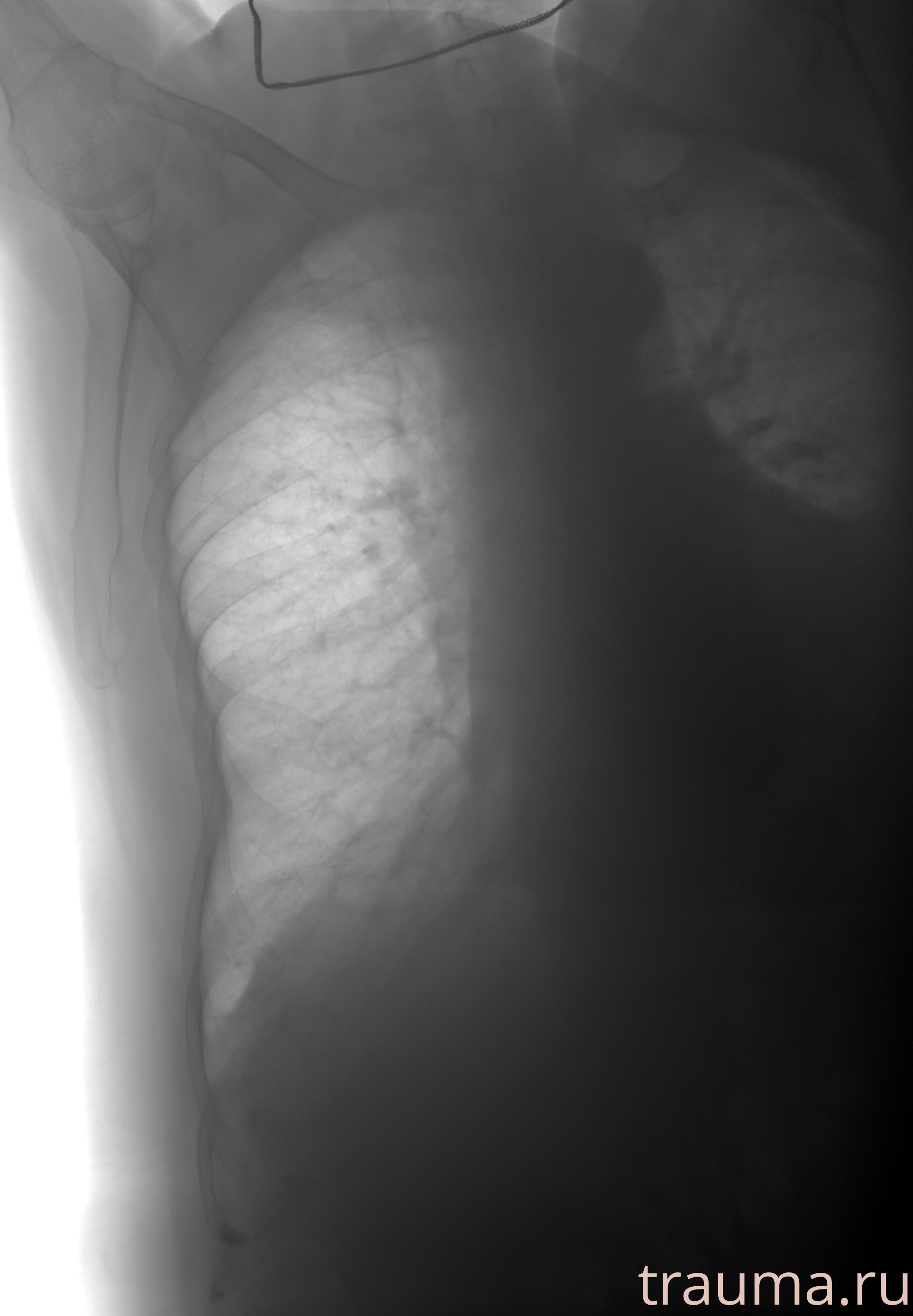 Рентген на дому: по вашему адресу приезжает врач-рентгенолог, травматолог-ортопед с мобильным рентгеновским аппаратом, проводит диагностику травмы или заболевания, делает необходимые рентгенограммы, дает рекомендации по дальнейшему лечению. Получить качественные снимки в домашних условиях возможно благодаря уникальной методике, разработанной МосРентген Центром для института  Склифосовского