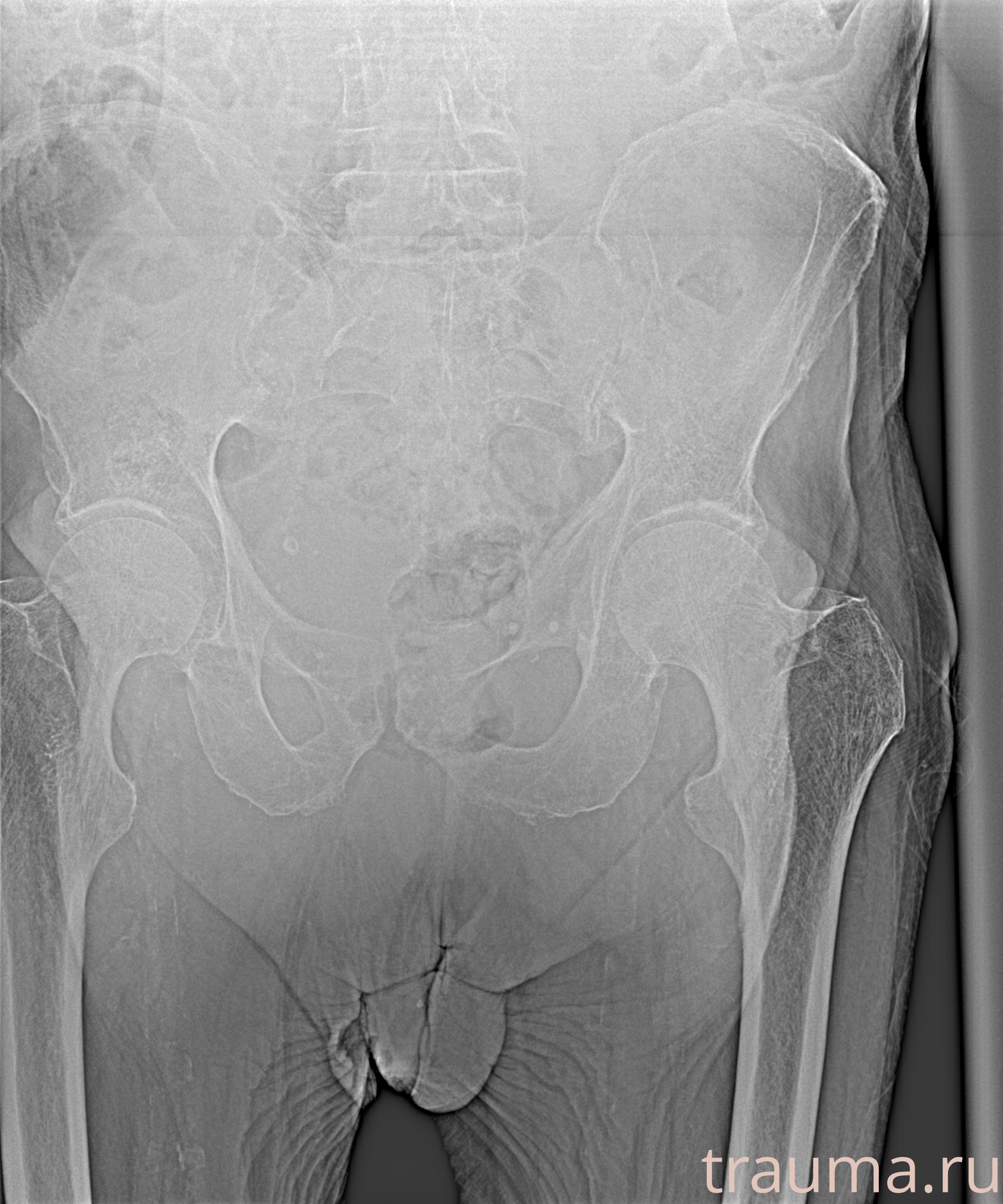 Рентген на дому: по вашему адресу приезжает врач-рентгенолог, травматолог-ортопед с мобильным рентгеновским аппаратом, проводит диагностику травмы или заболевания, делает необходимые рентгенограммы, дает рекомендации по дальнейшему лечению. Получить качественные снимки в домашних условиях возможно благодаря уникальной методике, разработанной МосРентген Центром для института  Склифосовского