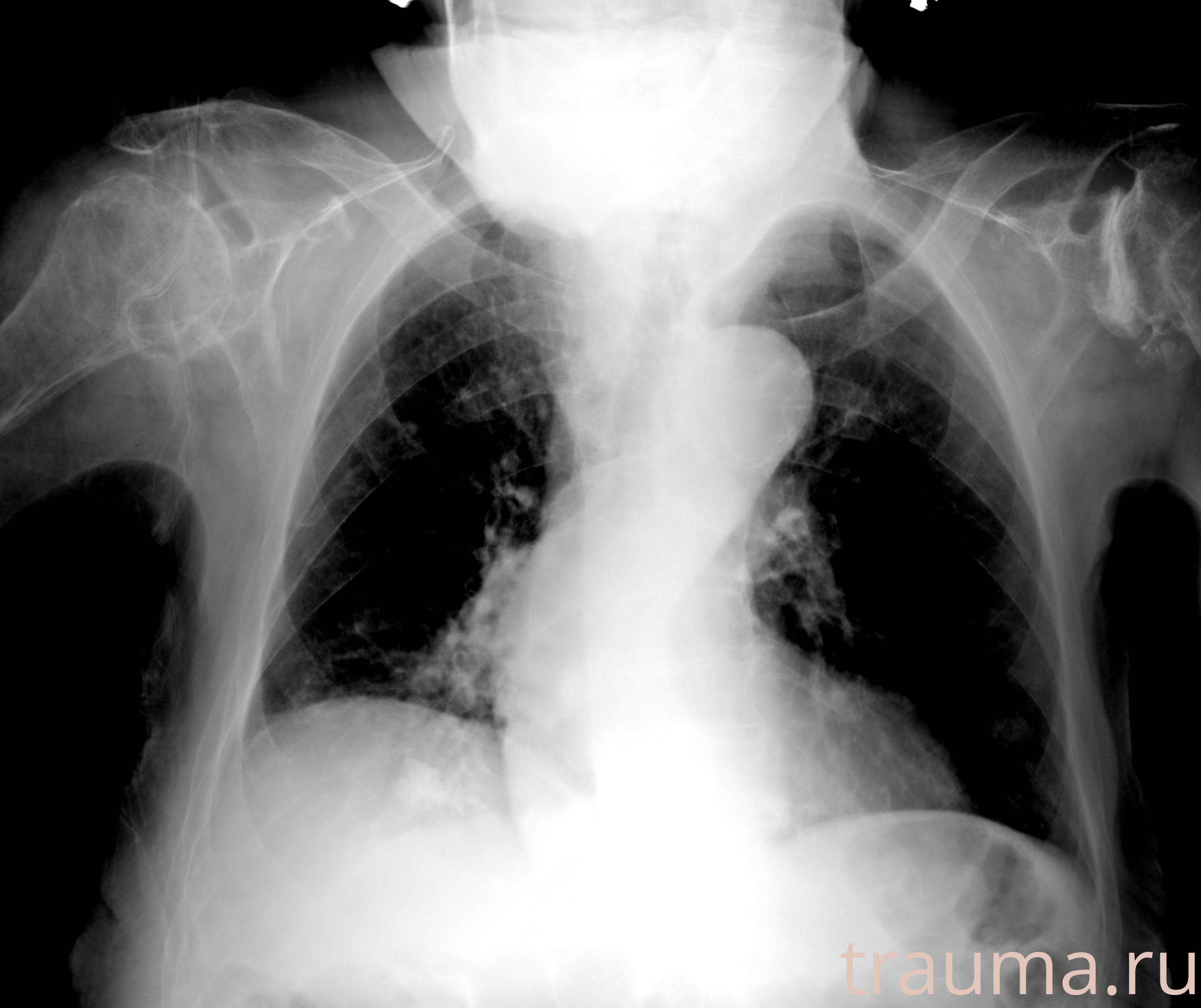 Рентген на дому: по вашему адресу приезжает врач-рентгенолог, травматолог-ортопед с мобильным рентгеновским аппаратом, проводит диагностику травмы или заболевания, делает необходимые рентгенограммы, дает рекомендации по дальнейшему лечению. Получить качественные снимки в домашних условиях возможно благодаря уникальной методике, разработанной МосРентген Центром для института  Склифосовского