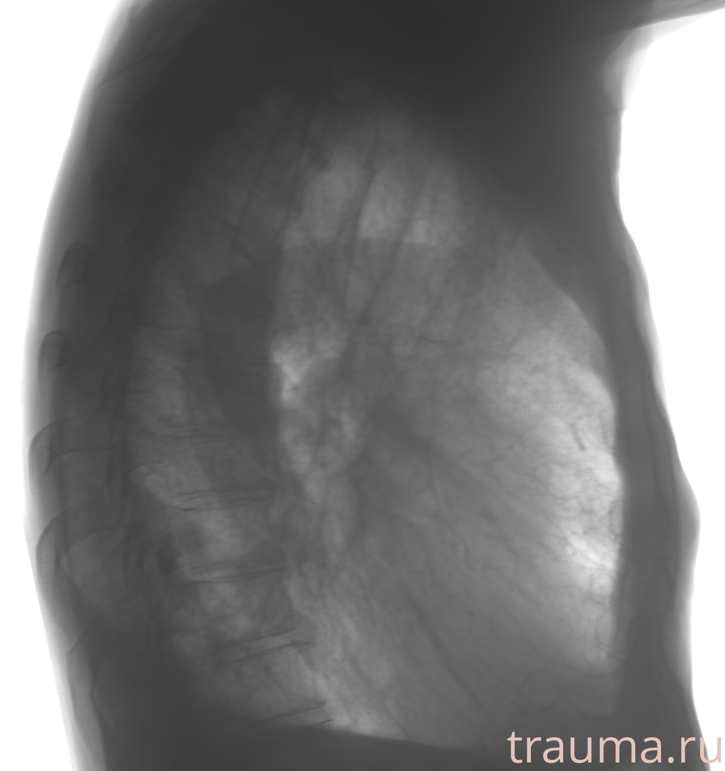 Рентген на дому: по вашему адресу приезжает врач-рентгенолог, травматолог-ортопед с мобильным рентгеновским аппаратом, проводит диагностику травмы или заболевания, делает необходимые рентгенограммы, дает рекомендации по дальнейшему лечению. Получить качественные снимки в домашних условиях возможно благодаря уникальной методике, разработанной МосРентген Центром для института  Склифосовского