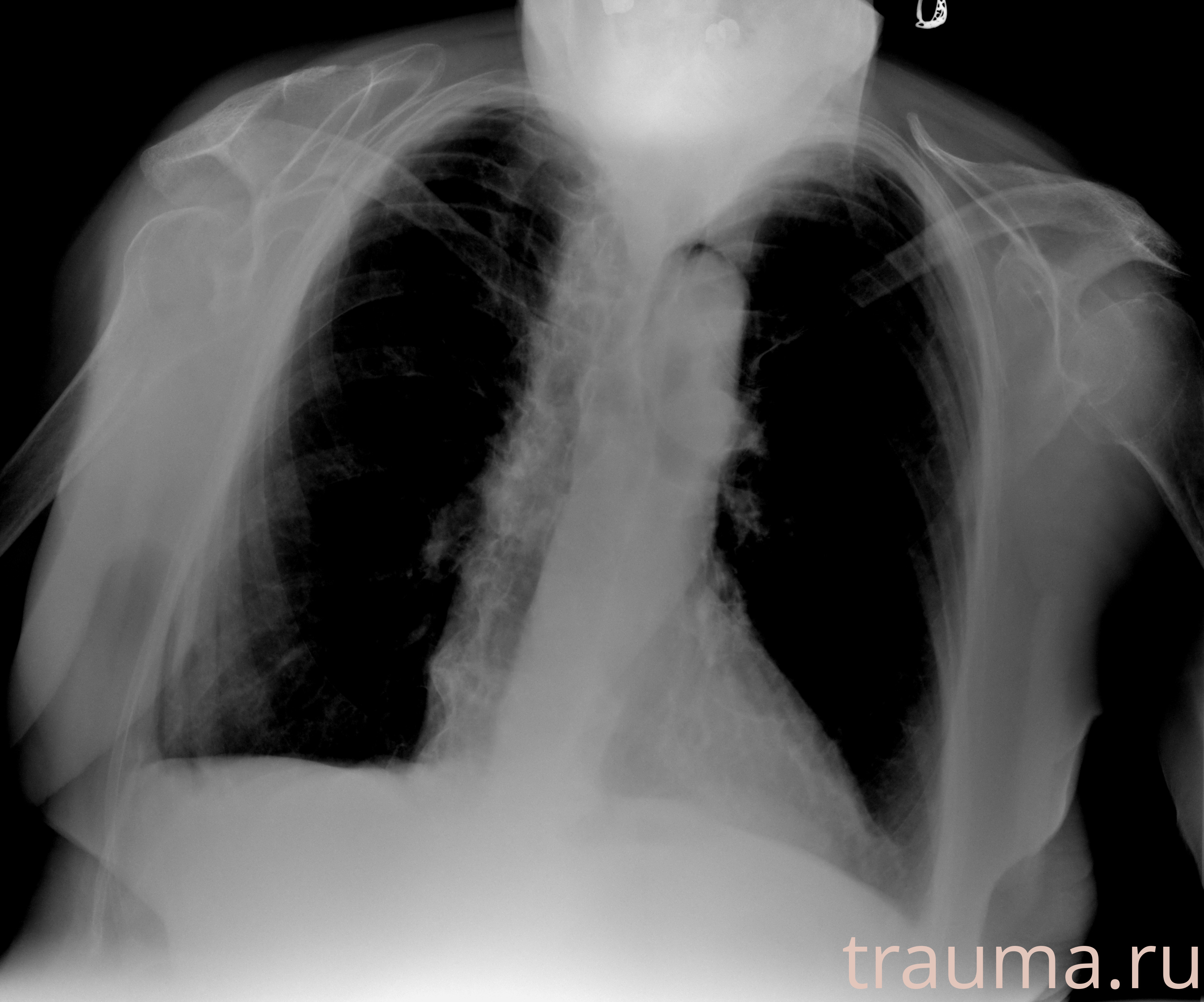 Рентген на дому: по вашему адресу приезжает врач-рентгенолог, травматолог-ортопед с мобильным рентгеновским аппаратом, проводит диагностику травмы или заболевания, делает необходимые рентгенограммы, дает рекомендации по дальнейшему лечению. Получить качественные снимки в домашних условиях возможно благодаря уникальной методике, разработанной МосРентген Центром для института  Склифосовского