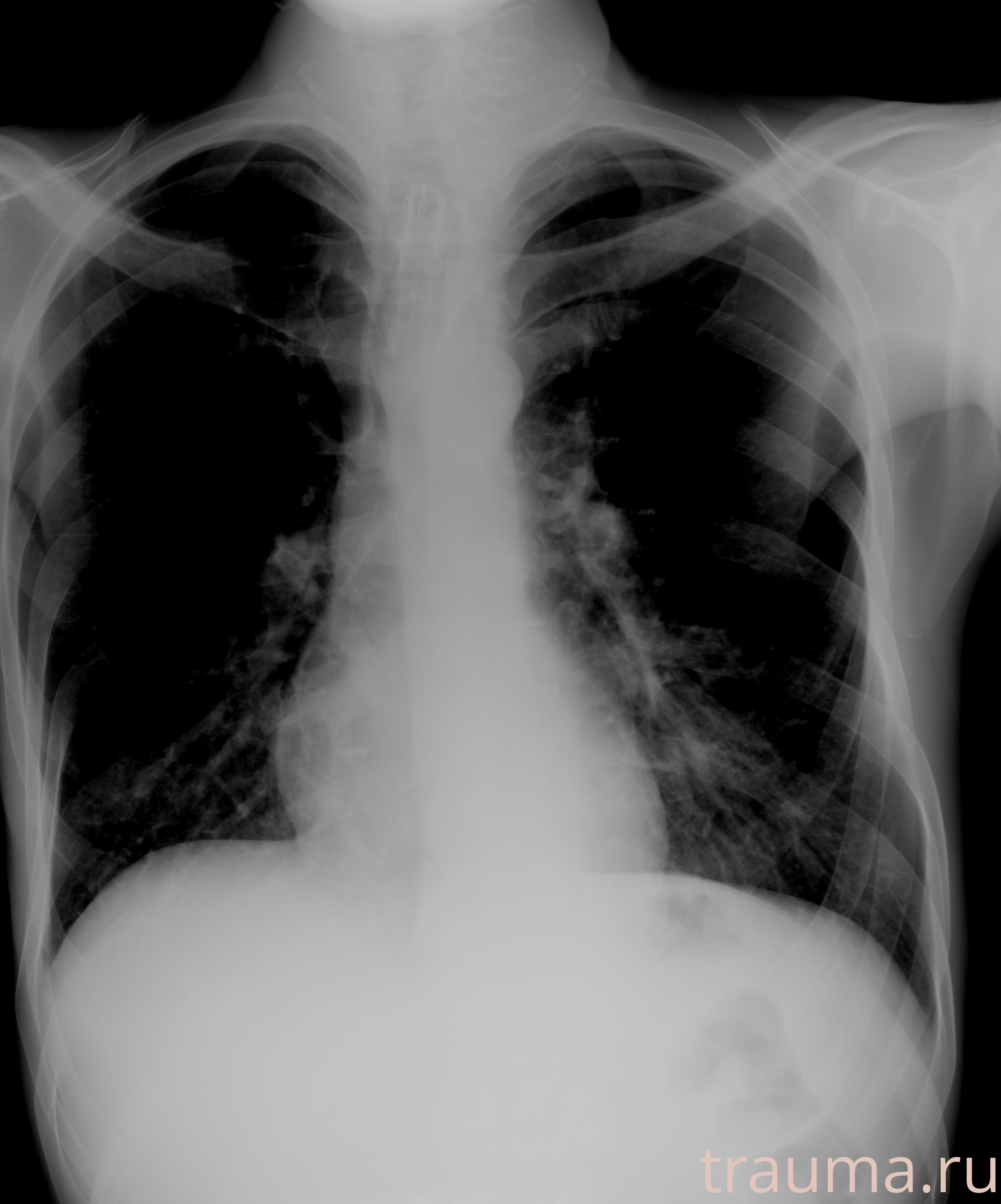 Рентген на дому: по вашему адресу приезжает врач-рентгенолог, травматолог-ортопед с мобильным рентгеновским аппаратом, проводит диагностику травмы или заболевания, делает необходимые рентгенограммы, дает рекомендации по дальнейшему лечению. Получить качественные снимки в домашних условиях возможно благодаря уникальной методике, разработанной МосРентген Центром для института  Склифосовского