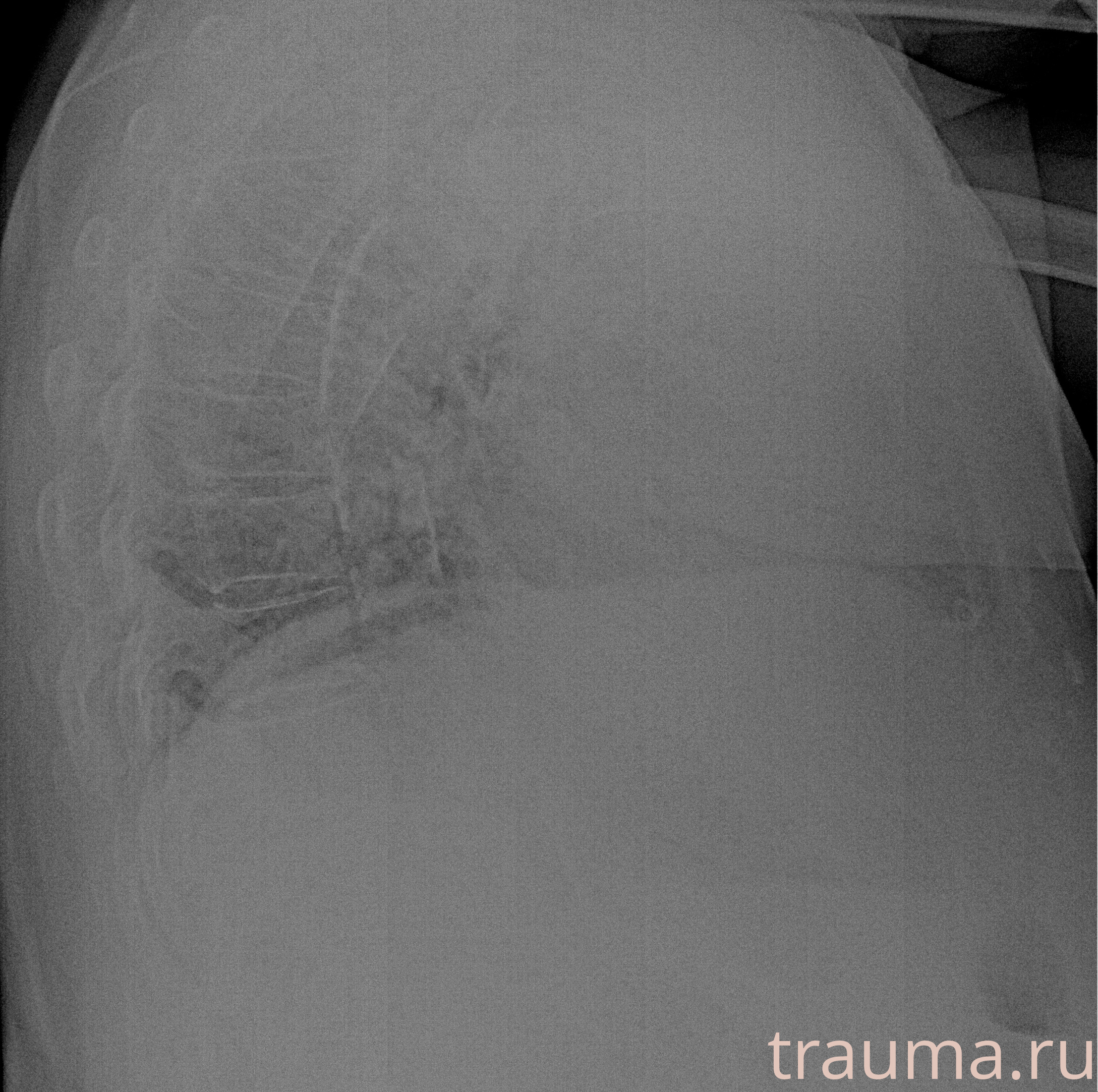 Рентген на дому: по вашему адресу приезжает врач-рентгенолог, травматолог-ортопед с мобильным рентгеновским аппаратом, проводит диагностику травмы или заболевания, делает необходимые рентгенограммы, дает рекомендации по дальнейшему лечению. Получить качественные снимки в домашних условиях возможно благодаря уникальной методике, разработанной МосРентген Центром для института  Склифосовского
