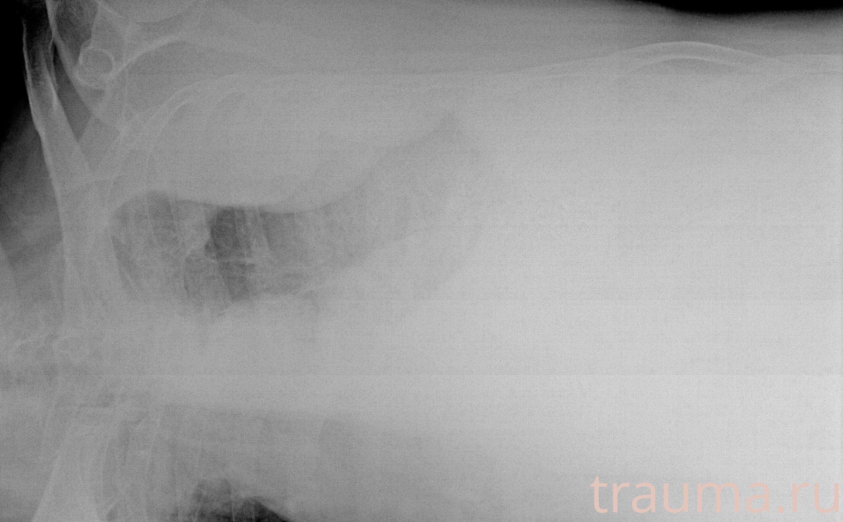 Рентген на дому: по вашему адресу приезжает врач-рентгенолог, травматолог-ортопед с мобильным рентгеновским аппаратом, проводит диагностику травмы или заболевания, делает необходимые рентгенограммы, дает рекомендации по дальнейшему лечению. Получить качественные снимки в домашних условиях возможно благодаря уникальной методике, разработанной МосРентген Центром для института  Склифосовского