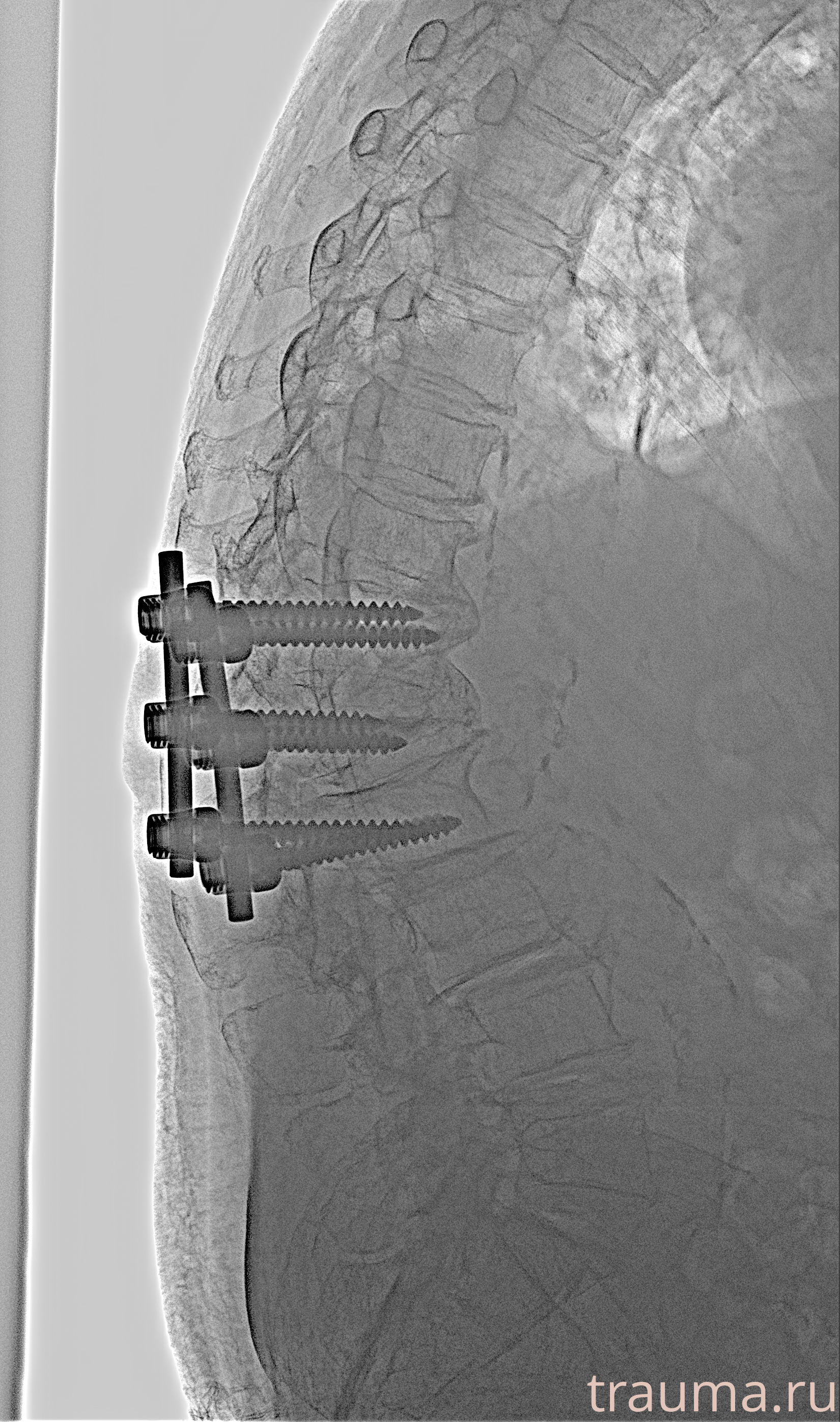 Рентген на дому: по вашему адресу приезжает врач-рентгенолог, травматолог-ортопед с мобильным рентгеновским аппаратом, проводит диагностику травмы или заболевания, делает необходимые рентгенограммы, дает рекомендации по дальнейшему лечению. Получить качественные снимки в домашних условиях возможно благодаря уникальной методике, разработанной МосРентген Центром для института  Склифосовского