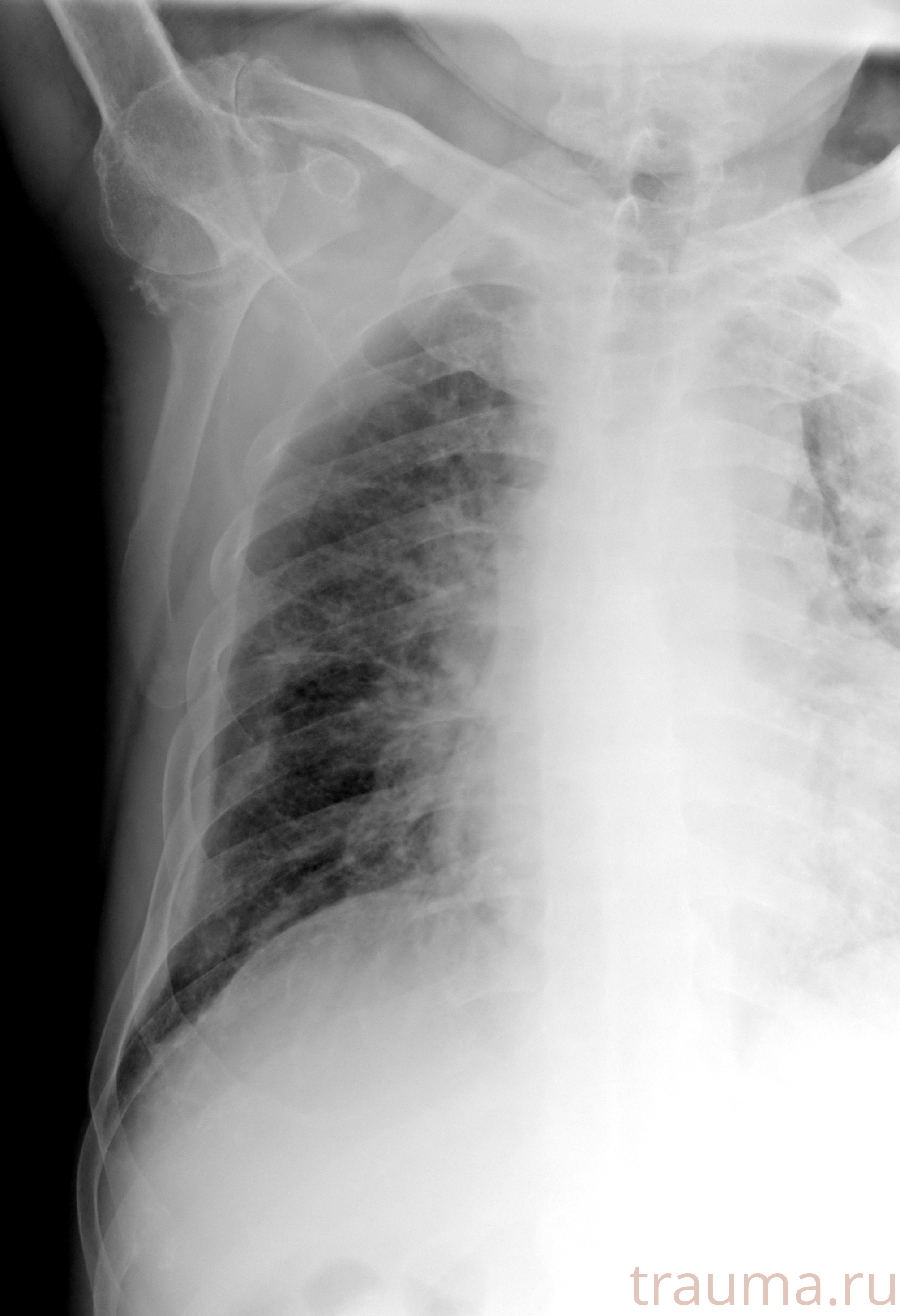 Рентген на дому: по вашему адресу приезжает врач-рентгенолог, травматолог-ортопед с мобильным рентгеновским аппаратом, проводит диагностику травмы или заболевания, делает необходимые рентгенограммы, дает рекомендации по дальнейшему лечению. Получить качественные снимки в домашних условиях возможно благодаря уникальной методике, разработанной МосРентген Центром для института  Склифосовского