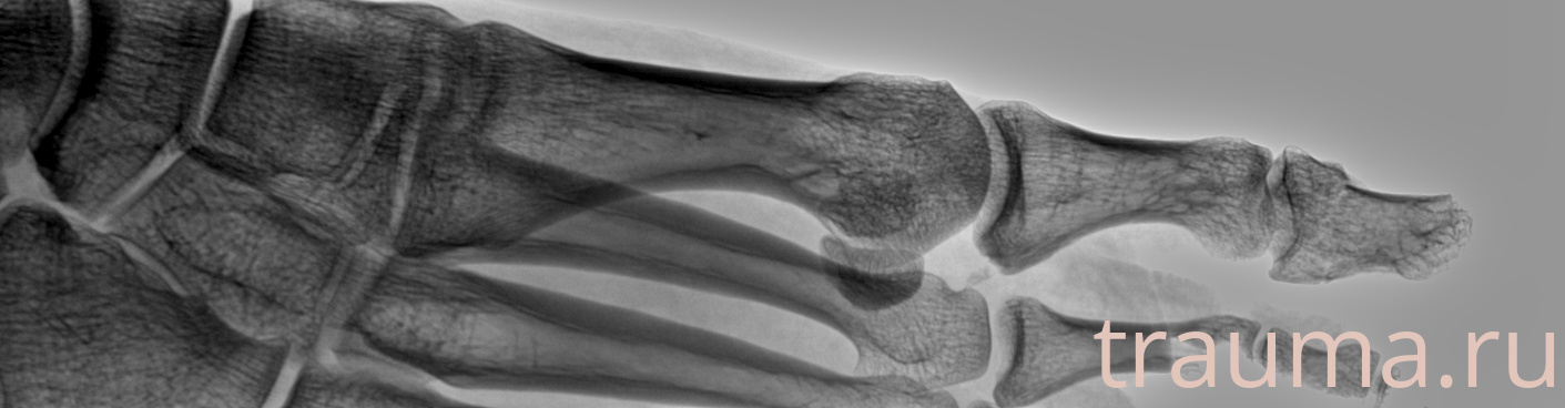 Рентген на дому: по вашему адресу приезжает врач-рентгенолог, травматолог-ортопед с мобильным рентгеновским аппаратом, проводит диагностику травмы или заболевания, делает необходимые рентгенограммы, дает рекомендации по дальнейшему лечению. Получить качественные снимки в домашних условиях возможно благодаря уникальной методике, разработанной МосРентген Центром для института  Склифосовского