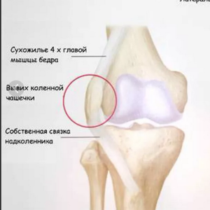 Новый метод хирургического лечения пациентов с привычным вывихом надколенника: анализ первичных результатов
Новый метод хирургического лечения пациентов с привычным вывихом надколенника: анализ первичных результатов