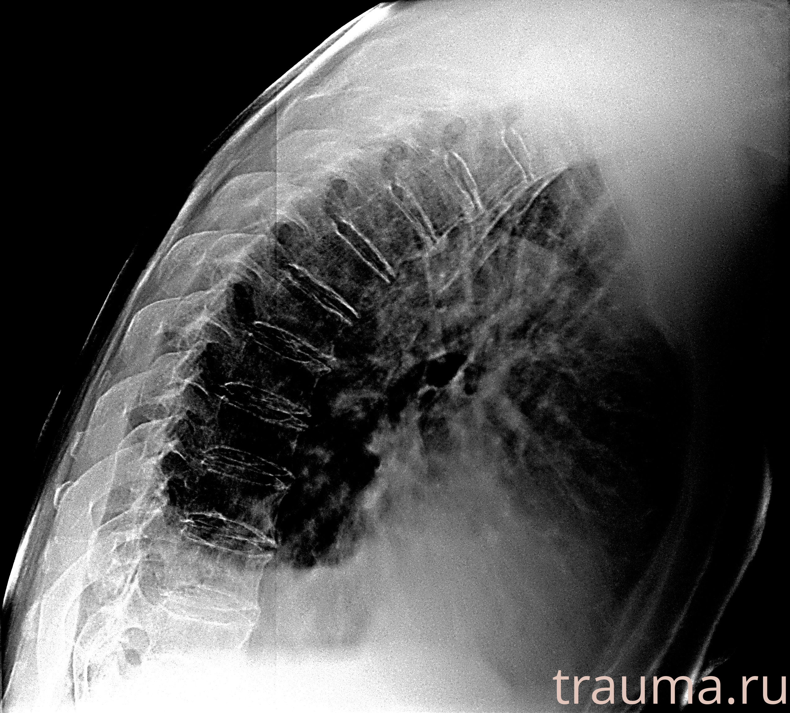 Рентген на дому: по вашему адресу приезжает врач-рентгенолог, травматолог-ортопед с мобильным рентгеновским аппаратом, проводит диагностику травмы или заболевания, делает необходимые рентгенограммы, дает рекомендации по дальнейшему лечению. Получить качественные снимки в домашних условиях возможно благодаря уникальной методике, разработанной МосРентген Центром для института  Склифосовского