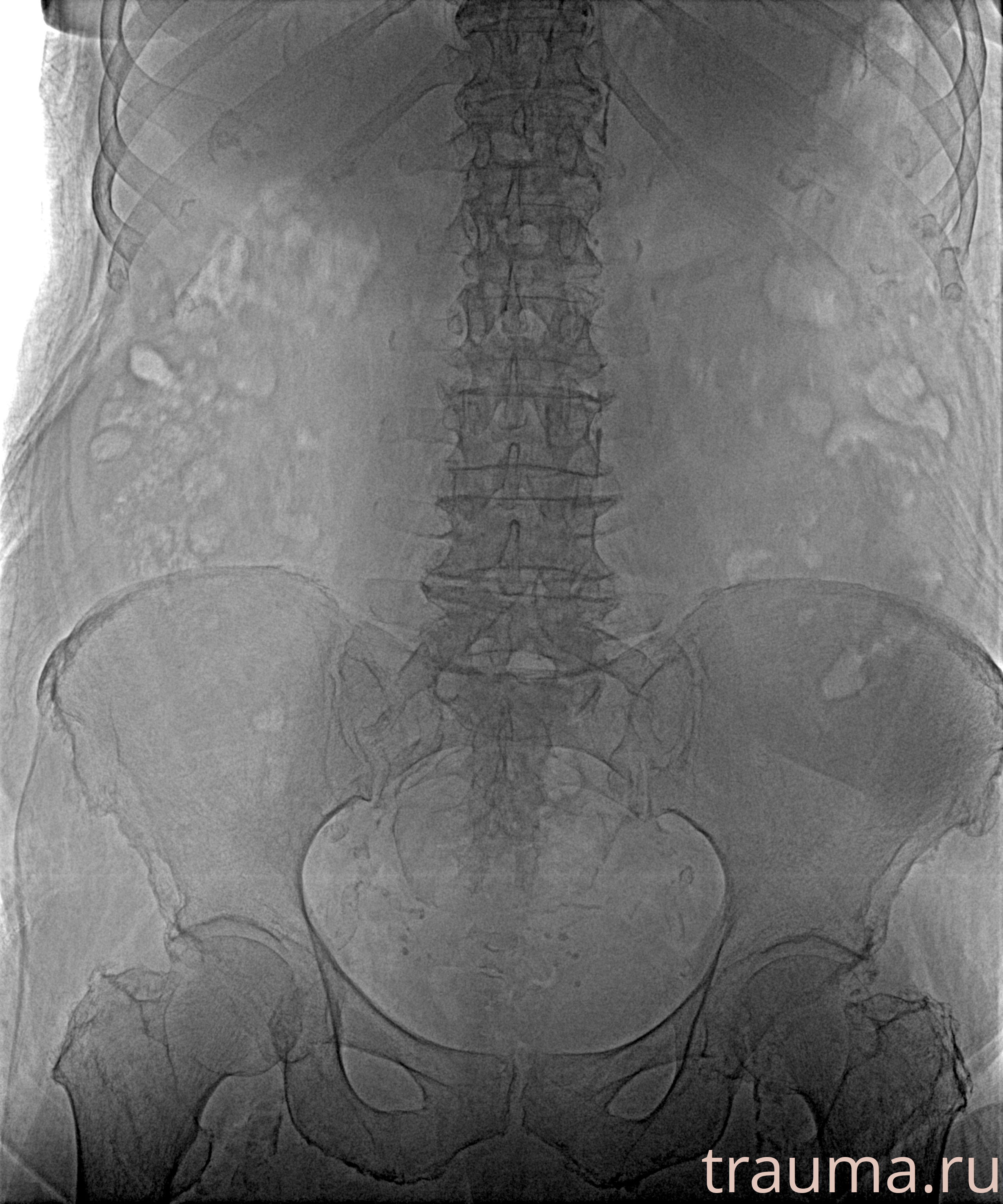 Рентген на дому: по вашему адресу приезжает врач-рентгенолог, травматолог-ортопед с мобильным рентгеновским аппаратом, проводит диагностику травмы или заболевания, делает необходимые рентгенограммы, дает рекомендации по дальнейшему лечению. Получить качественные снимки в домашних условиях возможно благодаря уникальной методике, разработанной МосРентген Центром для института  Склифосовского