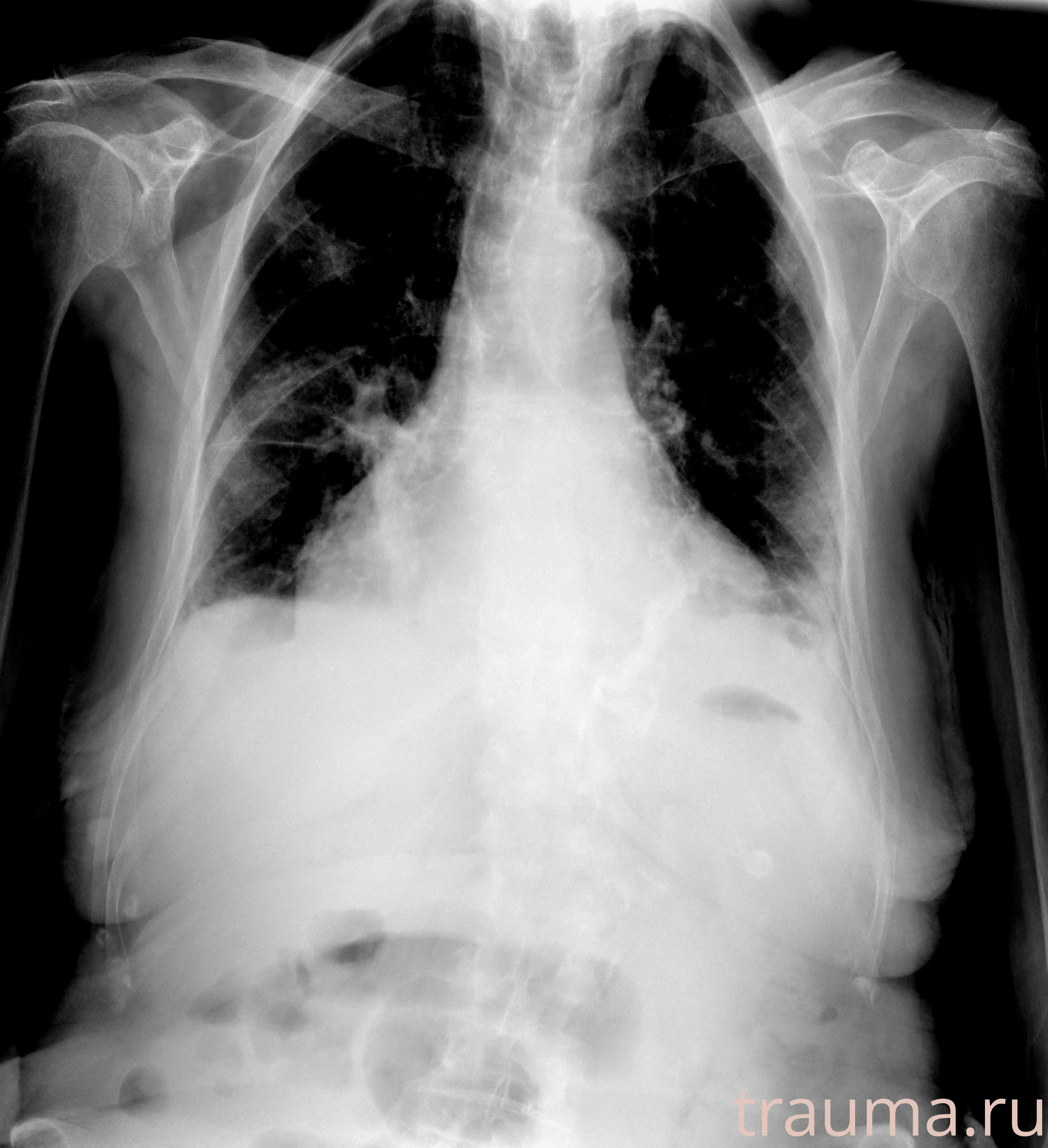 Рентген на дому: по вашему адресу приезжает врач-рентгенолог, травматолог-ортопед с мобильным рентгеновским аппаратом, проводит диагностику травмы или заболевания, делает необходимые рентгенограммы, дает рекомендации по дальнейшему лечению. Получить качественные снимки в домашних условиях возможно благодаря уникальной методике, разработанной МосРентген Центром для института  Склифосовского