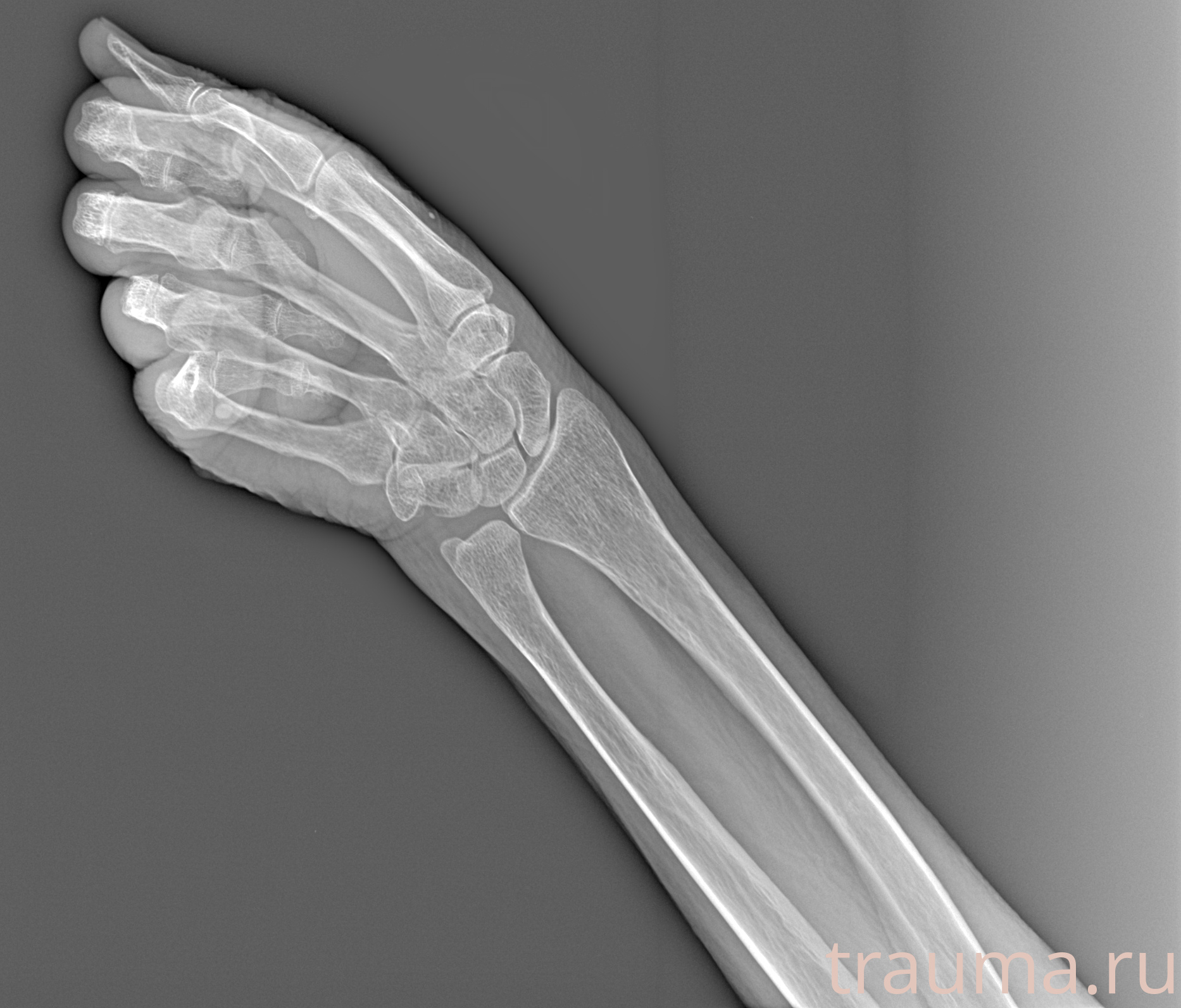 Рентген на дому: по вашему адресу приезжает врач-рентгенолог, травматолог-ортопед с мобильным рентгеновским аппаратом, проводит диагностику травмы или заболевания, делает необходимые рентгенограммы, дает рекомендации по дальнейшему лечению. Получить качественные снимки в домашних условиях возможно благодаря уникальной методике, разработанной МосРентген Центром для института  Склифосовского