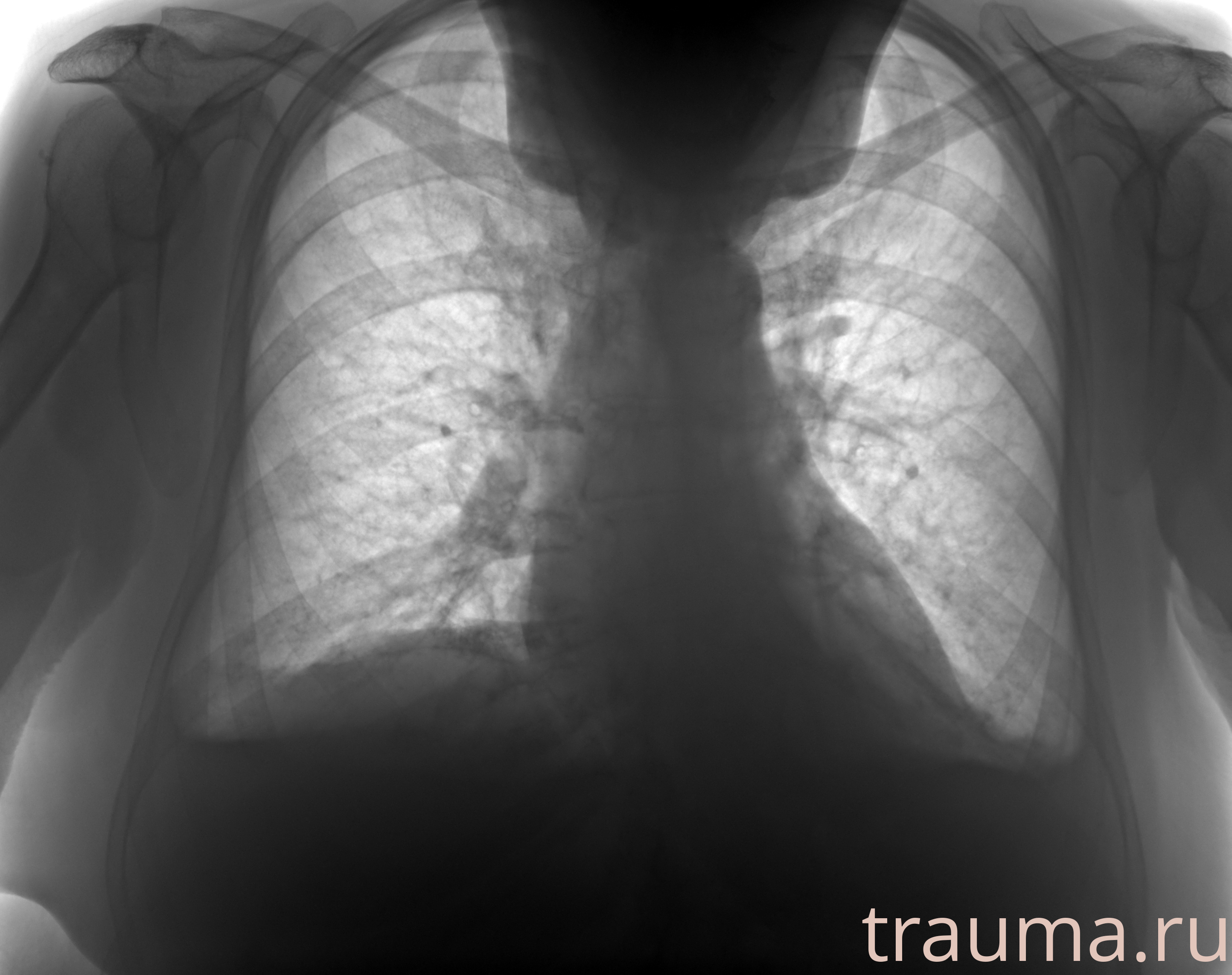 Рентген на дому: по вашему адресу приезжает врач-рентгенолог, травматолог-ортопед с мобильным рентгеновским аппаратом, проводит диагностику травмы или заболевания, делает необходимые рентгенограммы, дает рекомендации по дальнейшему лечению. Получить качественные снимки в домашних условиях возможно благодаря уникальной методике, разработанной МосРентген Центром для института  Склифосовского