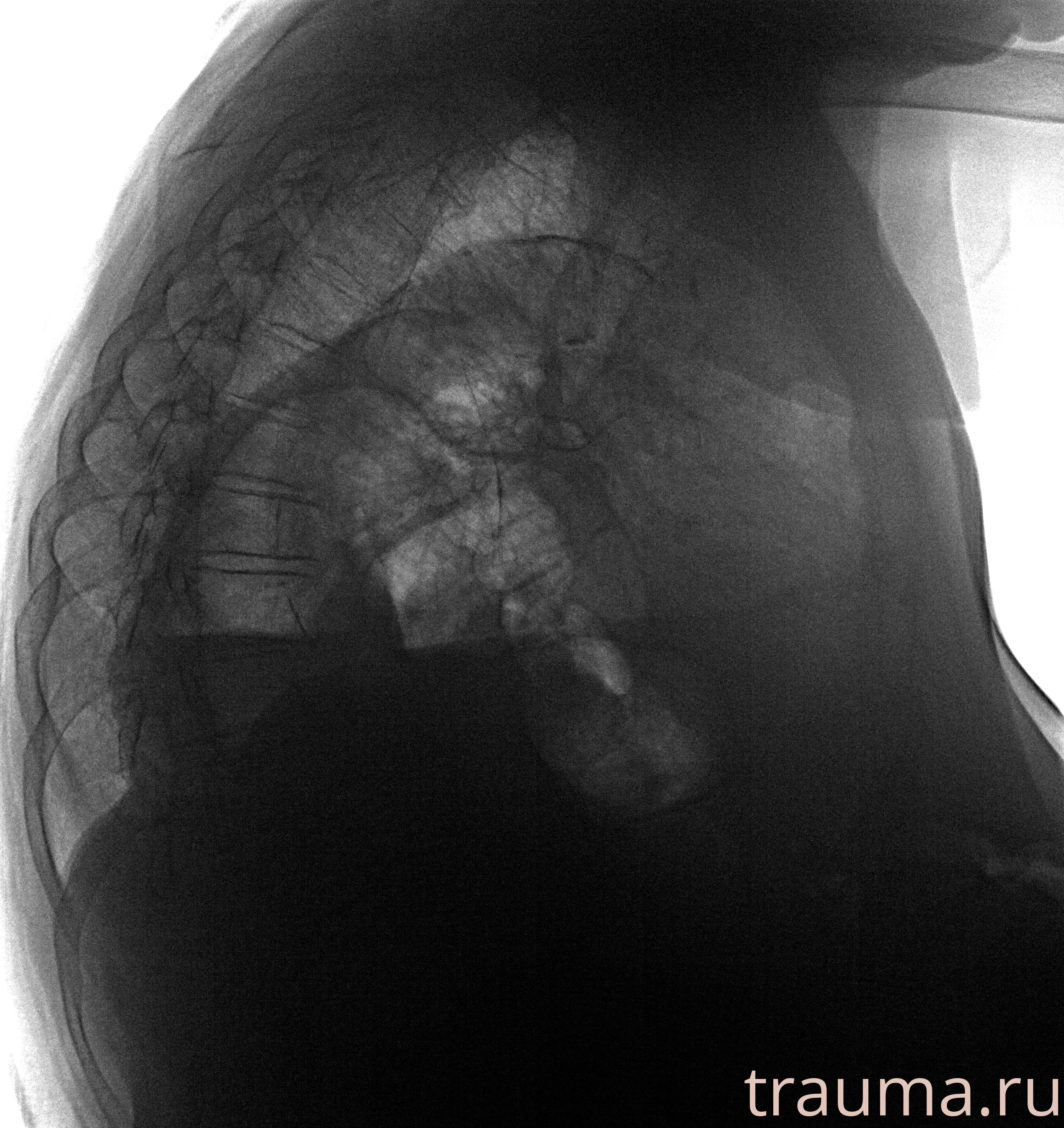 Рентген на дому: по вашему адресу приезжает врач-рентгенолог, травматолог-ортопед с мобильным рентгеновским аппаратом, проводит диагностику травмы или заболевания, делает необходимые рентгенограммы, дает рекомендации по дальнейшему лечению. Получить качественные снимки в домашних условиях возможно благодаря уникальной методике, разработанной МосРентген Центром для института  Склифосовского