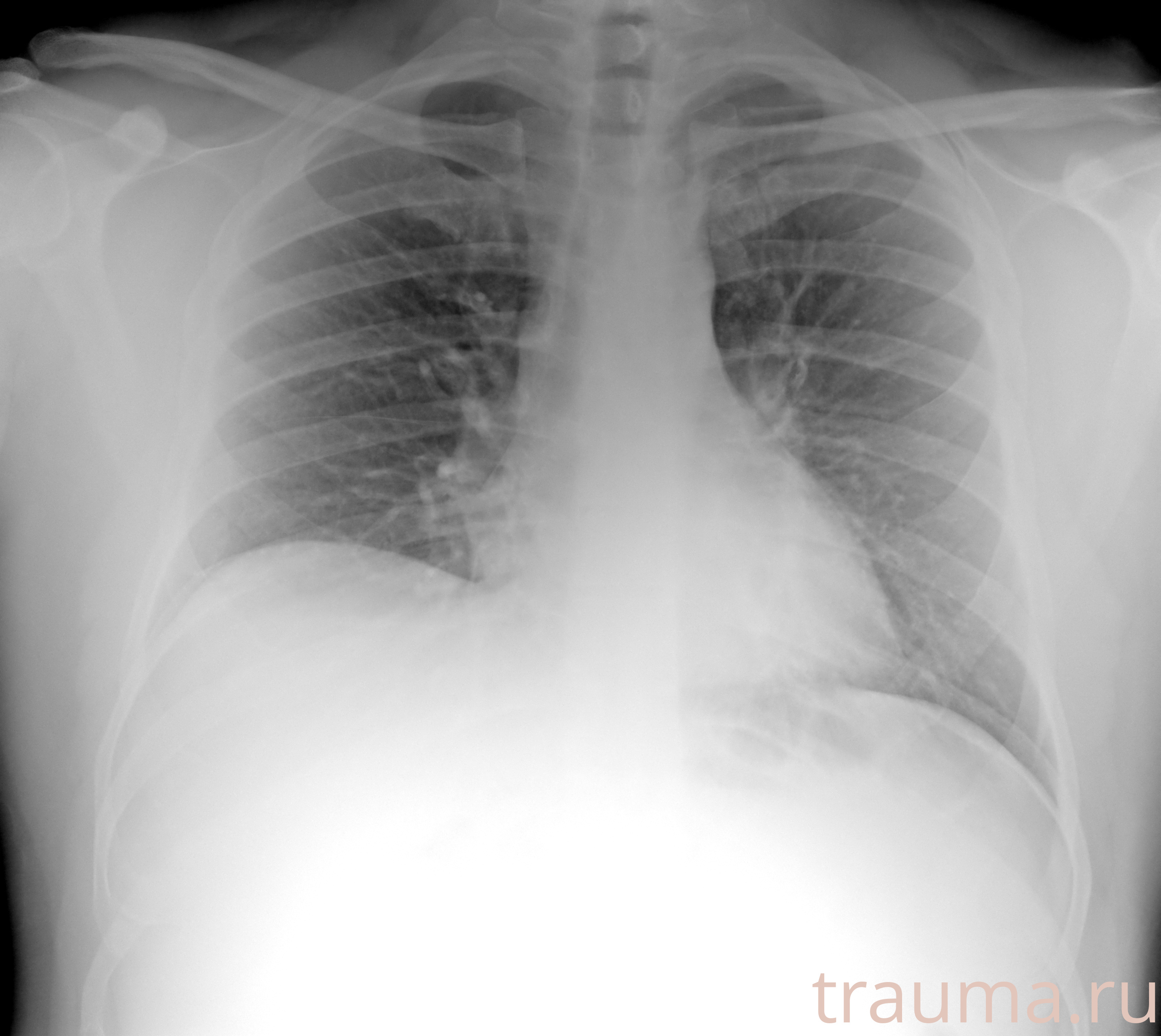 Рентген на дому: по вашему адресу приезжает врач-рентгенолог, травматолог-ортопед с мобильным рентгеновским аппаратом, проводит диагностику травмы или заболевания, делает необходимые рентгенограммы, дает рекомендации по дальнейшему лечению. Получить качественные снимки в домашних условиях возможно благодаря уникальной методике, разработанной МосРентген Центром для института  Склифосовского