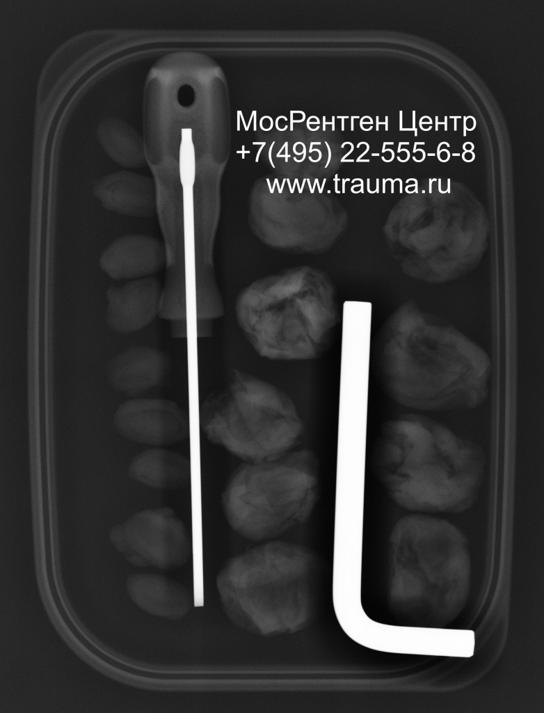 Чернослив в рентгене Чернослив в рентгене