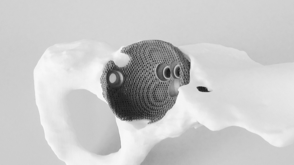 3D модель вертлужной впадины 3D модель вертлужной впадины