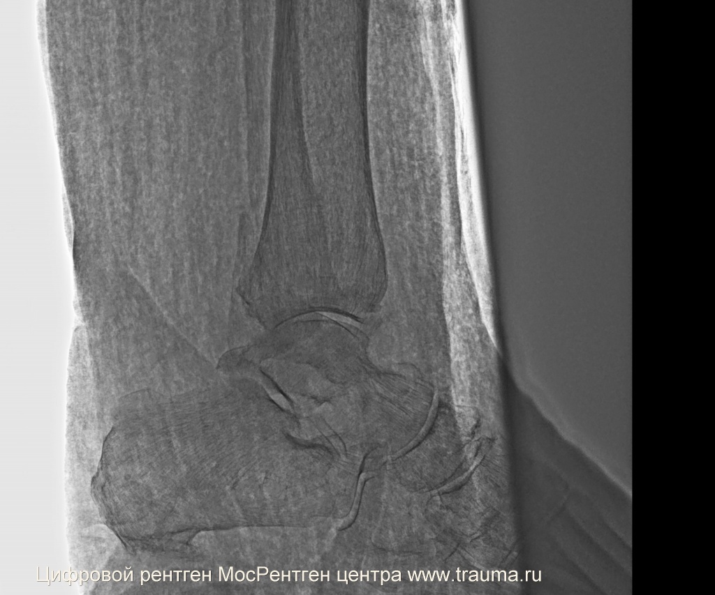 Цифровой рентген МосРентген центра www.trauma.ru Цифровой рентген МосРентген центра www.trauma.ru
