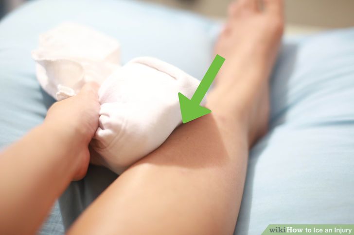 aid4541481-728px-Ice-an-Injury-Step-9-Version-2.jpg aid4541481-728px-Ice-an-Injury-Step-9-Version-2.jpg