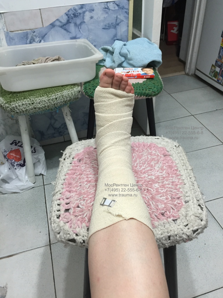 Повреждение голеностопного сустава Повреждение голеностопного сустава