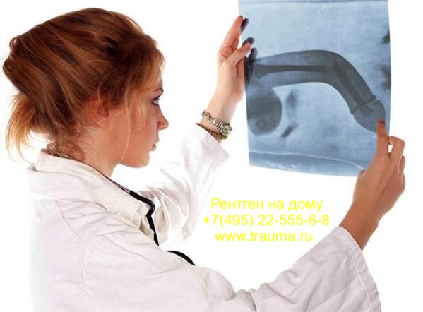 perelom_polovogo_chlena_na_rentgene.jpg