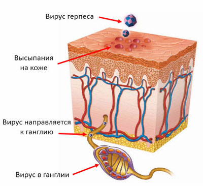 Где находится вирус герпеса Где находится вирус герпеса