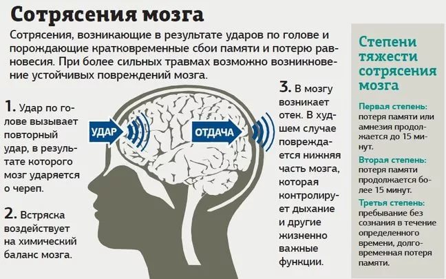 Сотрясение головного мозга