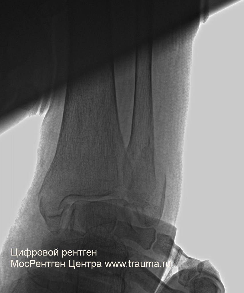 Цифровой рентген МосРентген Центра www.trauma.ru Цифровой рентген МосРентген Центра www.trauma.ru