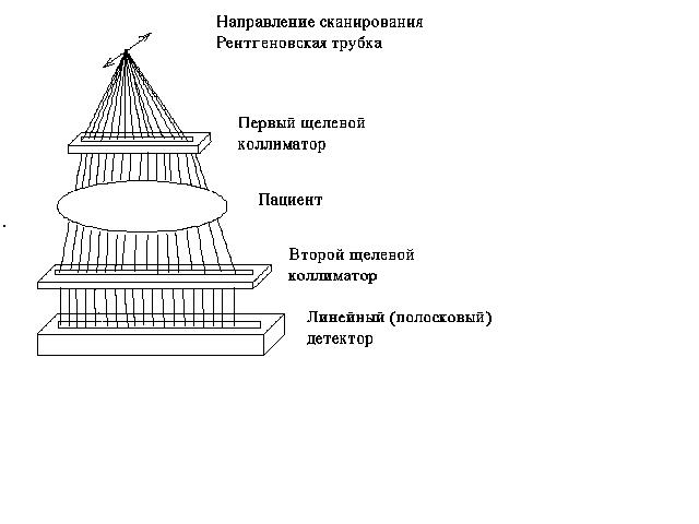 цифровой рентген