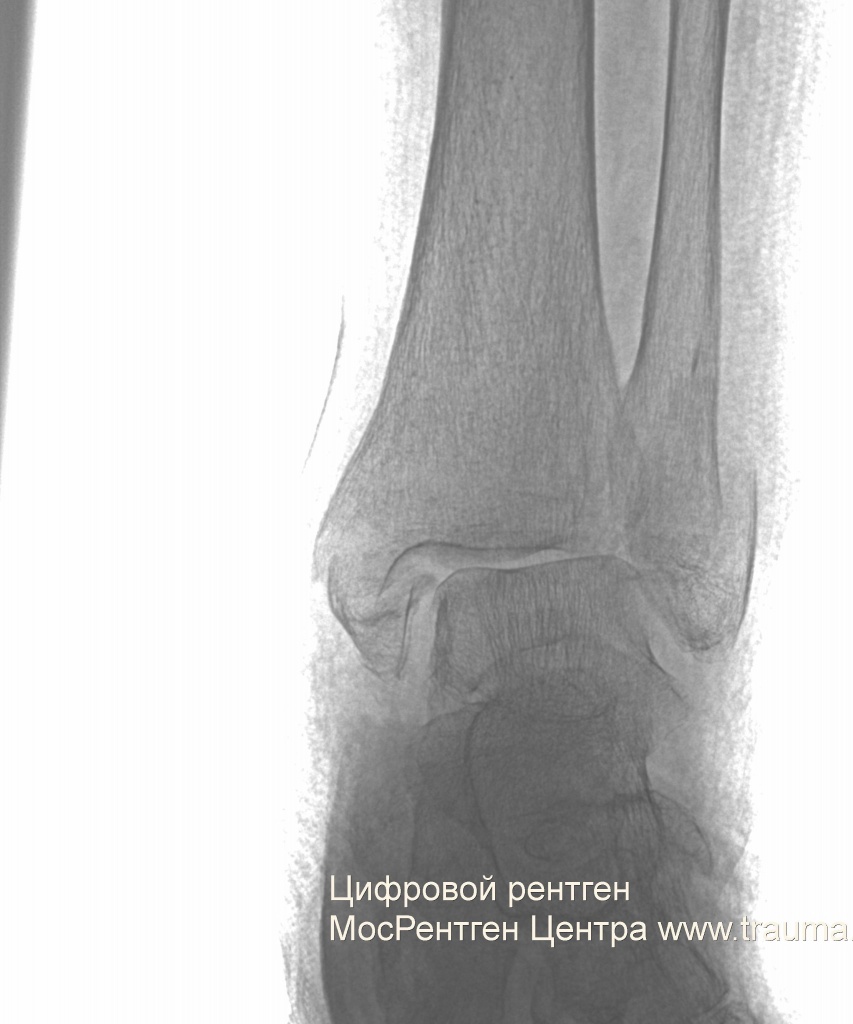 Цифровой рентген МосРентген Центра www.trauma.ru Цифровой рентген МосРентген Центра www.trauma.ru